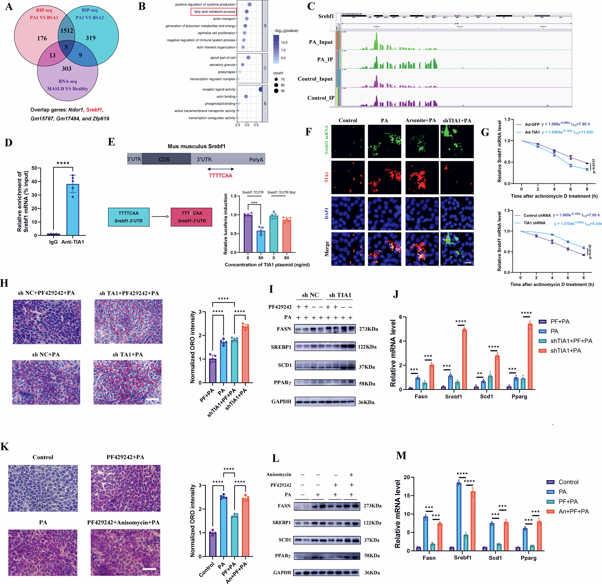 Fig. 6: TIA1 impedes MASH progression by binding to the 3’ UTR of Srebf1 mRNA and suppressing its translational activation.