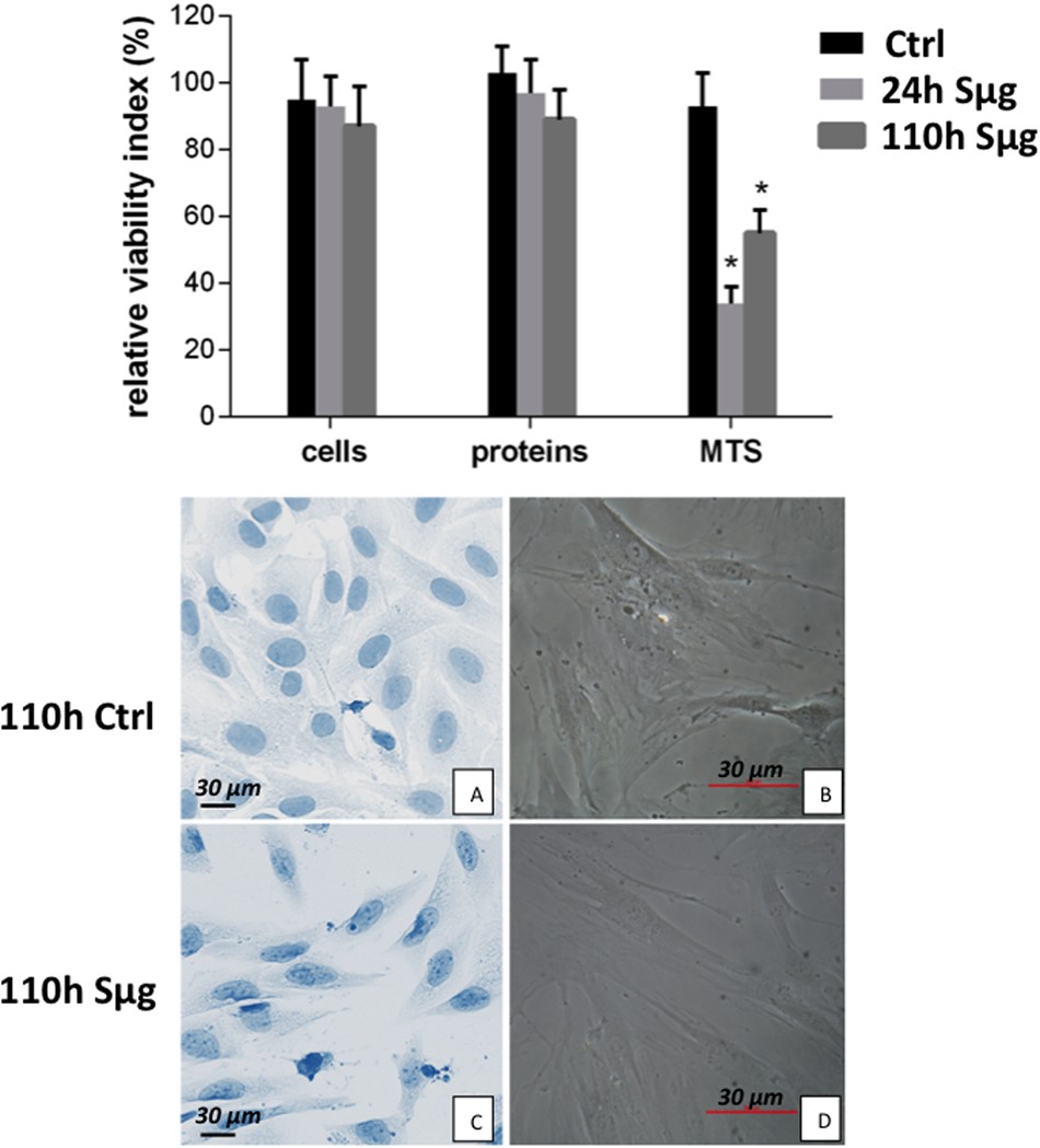 Simulated microgravity induces a cellular regression of the mature  phenotype in human primary osteoblasts | Cell Death Discovery