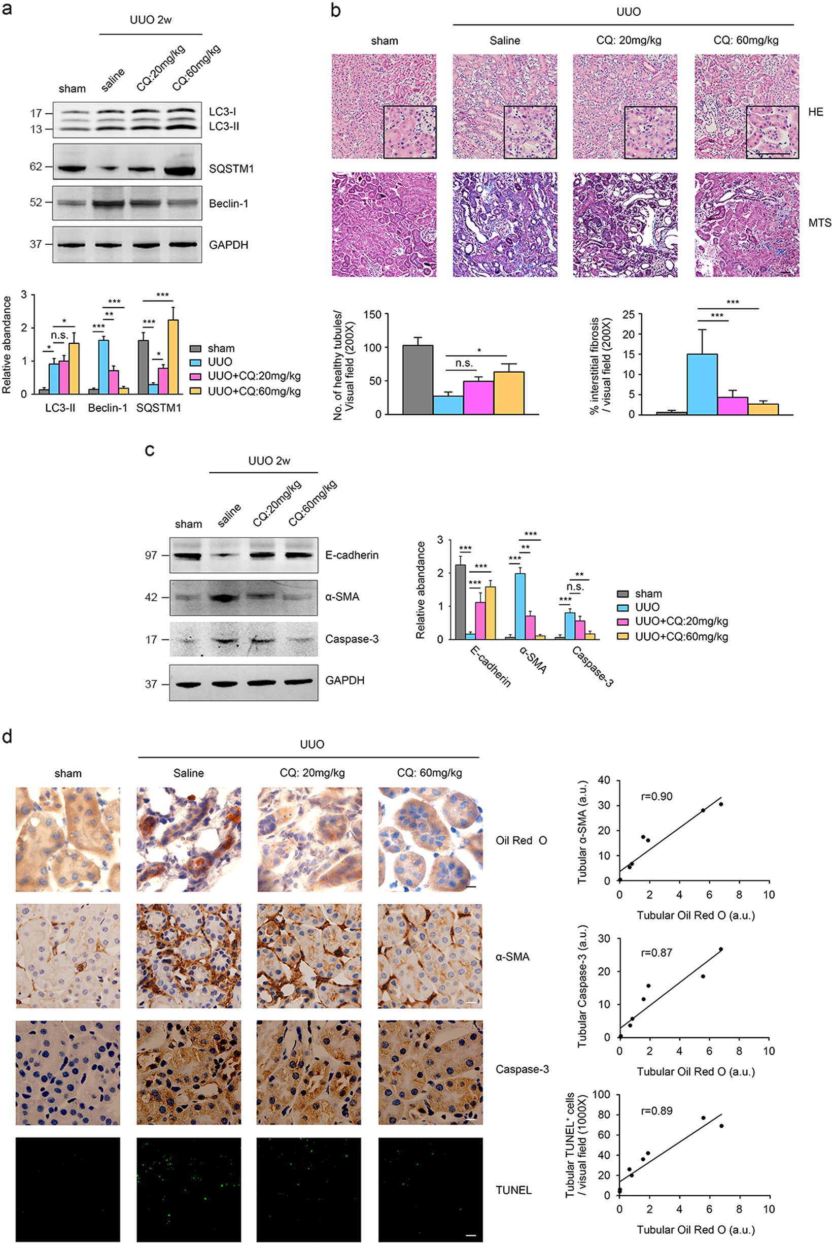 Fig. 6: Pharmacological inhibition of autophagy by CQ ameliorates fibrotic responses consistent with decreases in lipid deposition induced by UUO.