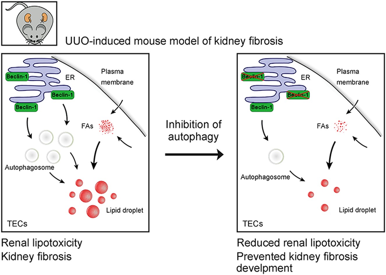 Fig. 7: Beclin-1 dependent autophagy activation contributes to lipotoxicity and fibrotic responses induced by UUO.