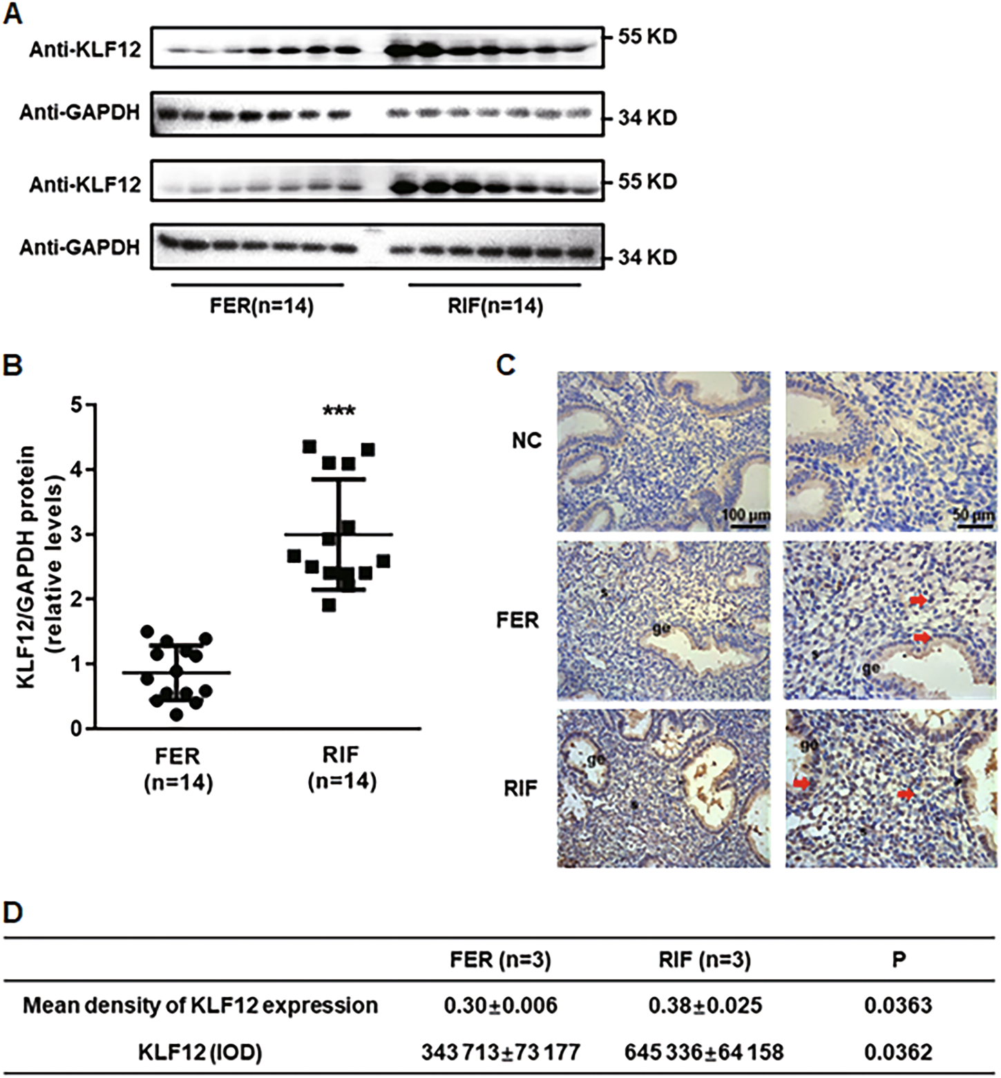 Fig. 1: Aberrant expression of KLF12 in the endometria of RIF patients.