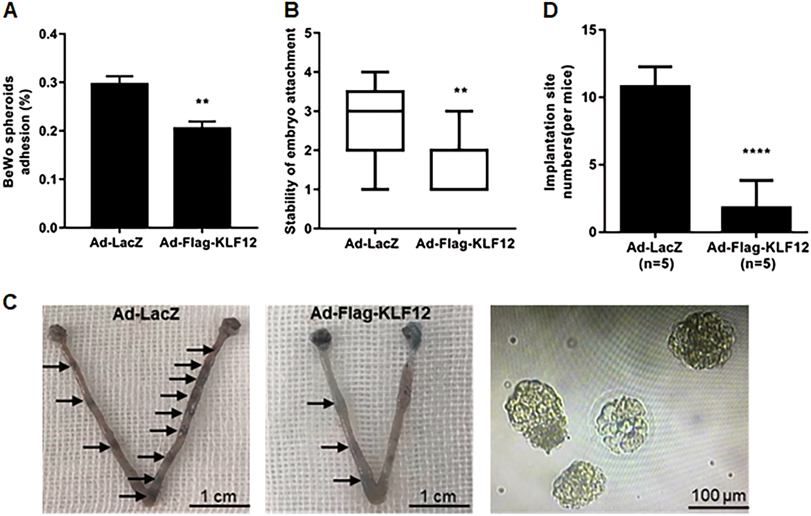 Fig. 2: KLF12 inhibits embryo implantation.