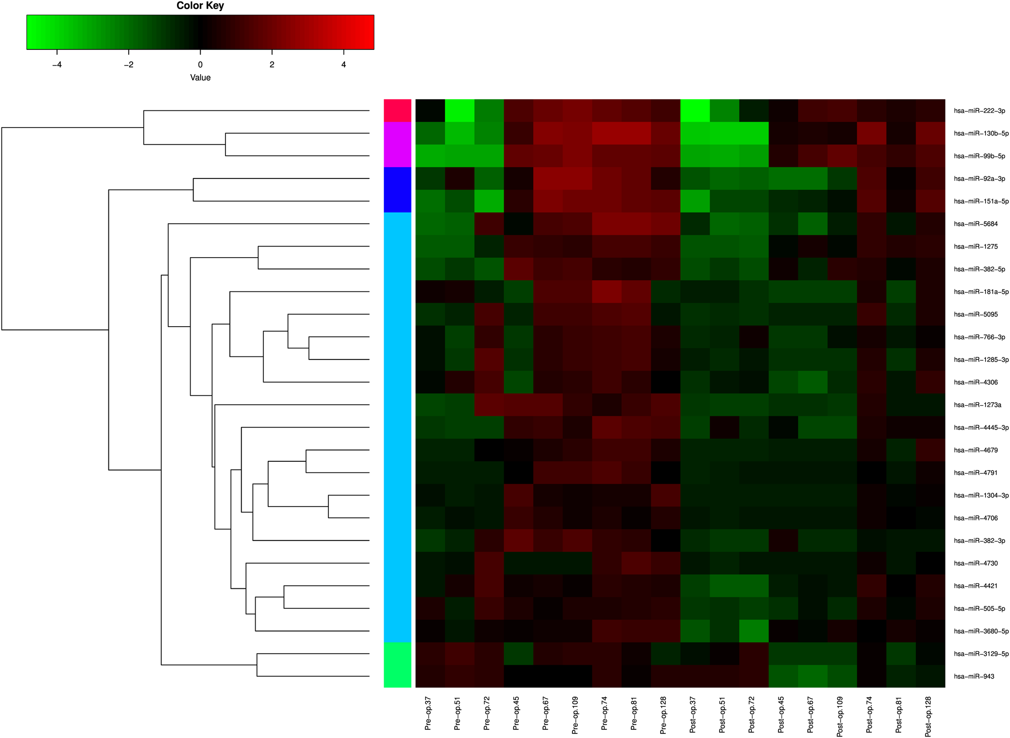 Fig. 1: Heat map and hierarchical clustering of downregulated miRNA expression signatures compared postoperative with preoperative signatures in nine matched-pair breast cancer patients’ samples.