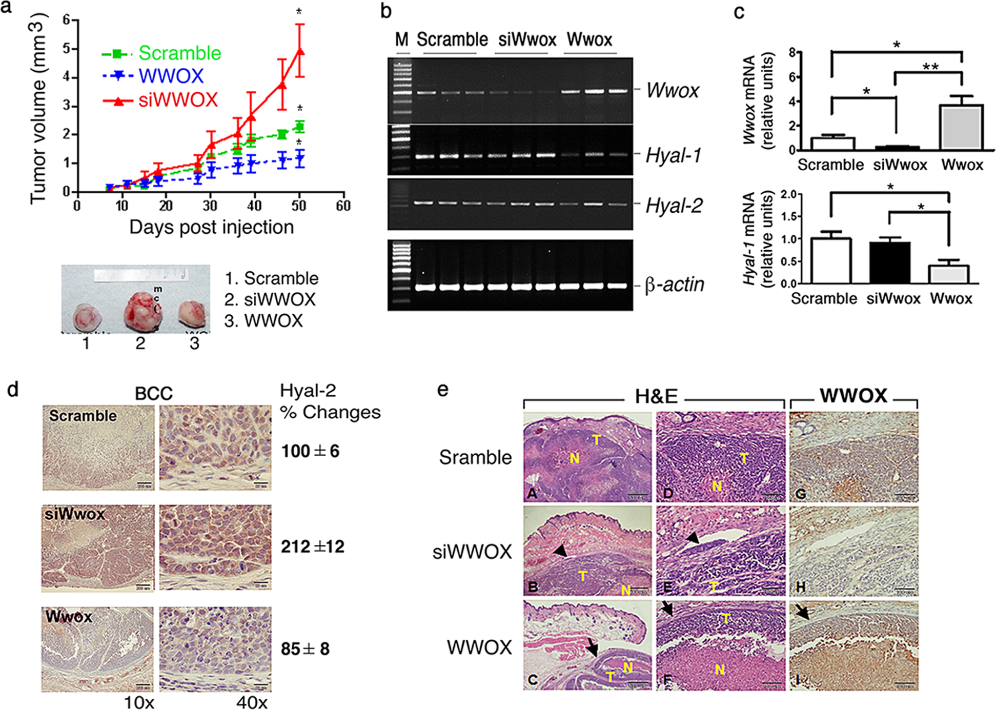 Strategies by which WWOX-deficient metastatic cancer cells utilize to  survive via dodging, compromising, and causing damage to WWOX-positive  normal microenvironment | Cell Death Discovery