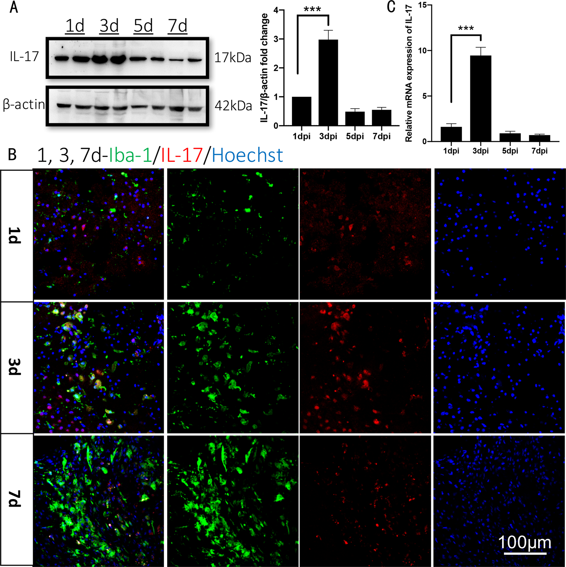 Fig. 1: IL-17 expresses differently at different time after stroke and peaks at 3 days in WT mice.
