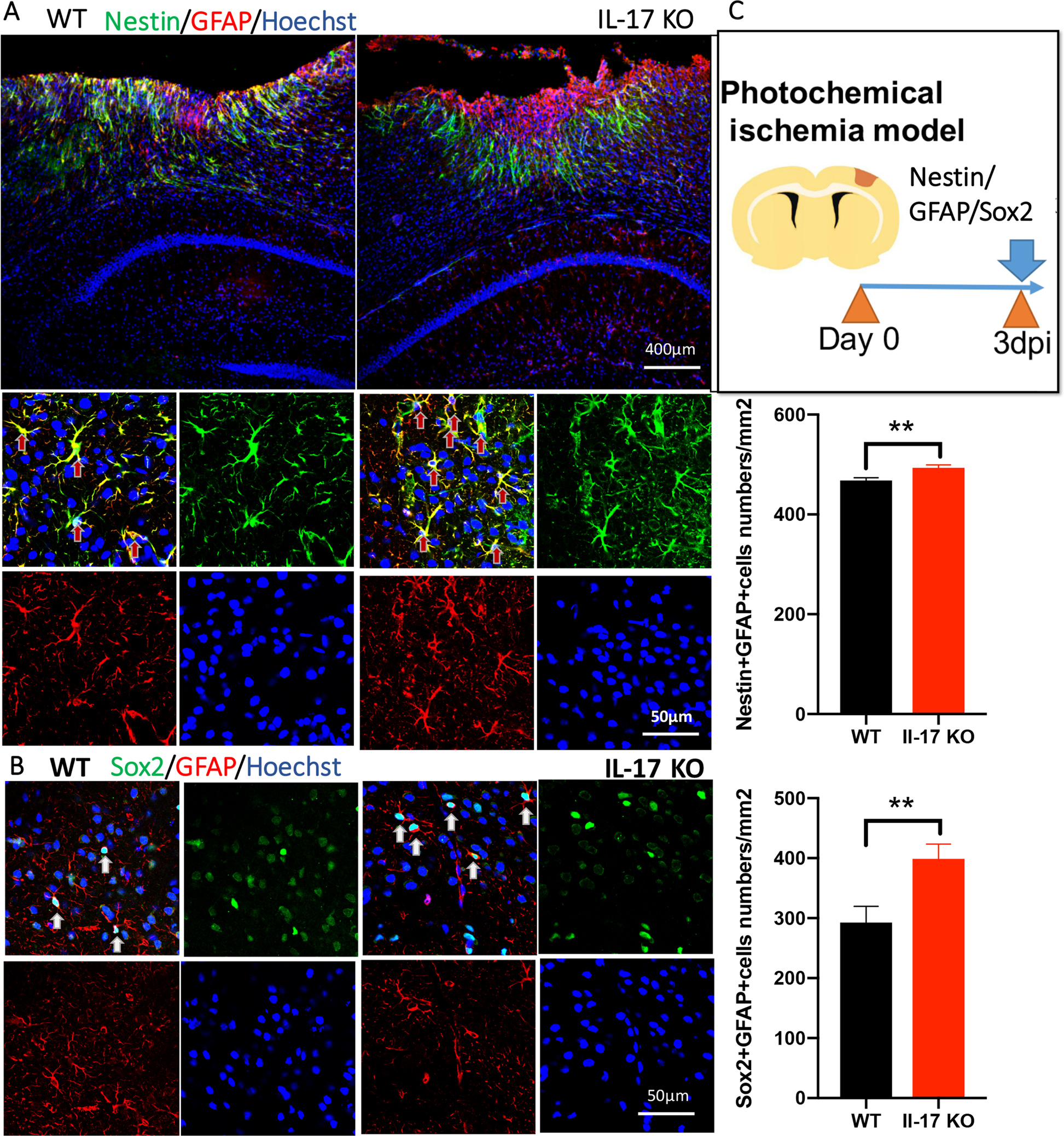 Fig. 3: NSCs’ stemness around the ischemic cortex is activated by knocking out IL-17.