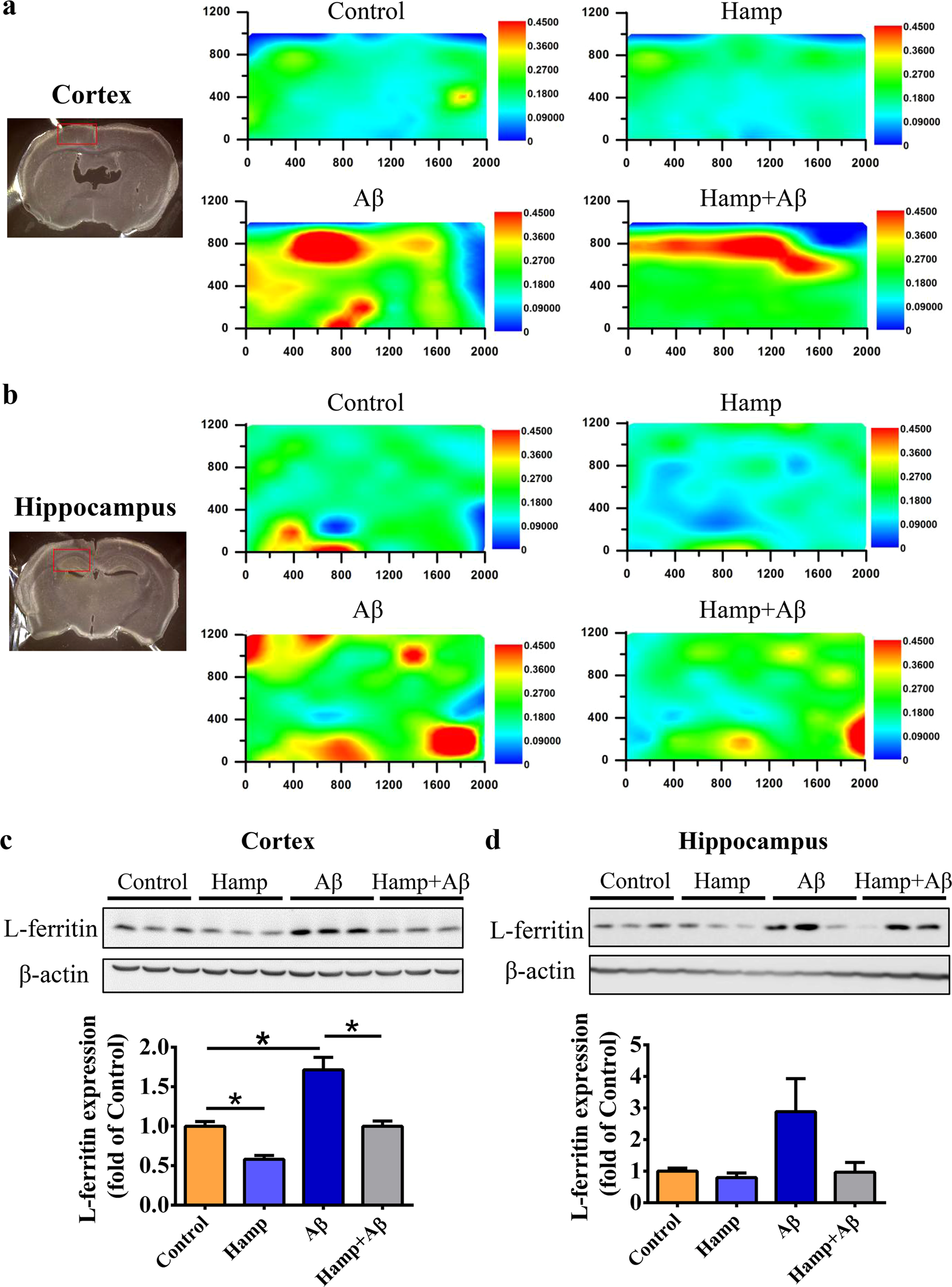 Fig. 4: Astrocyte hepcidin ameliorated Aβ-induced elevation in iron levels.