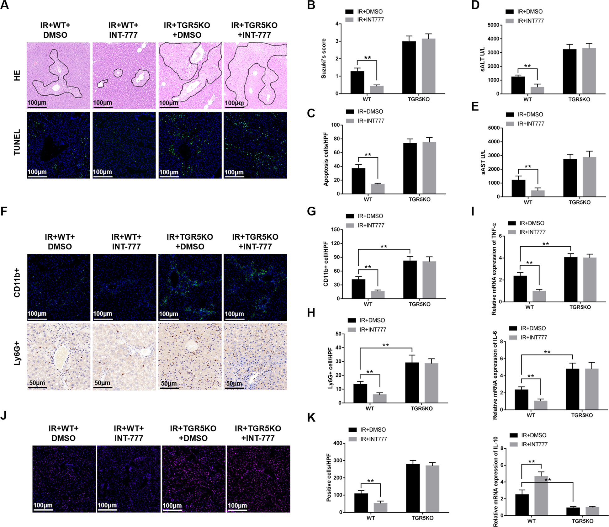 Fig. 3: TGR5 overexpression ameliorates hepatic ischemia/reperfusion injury.