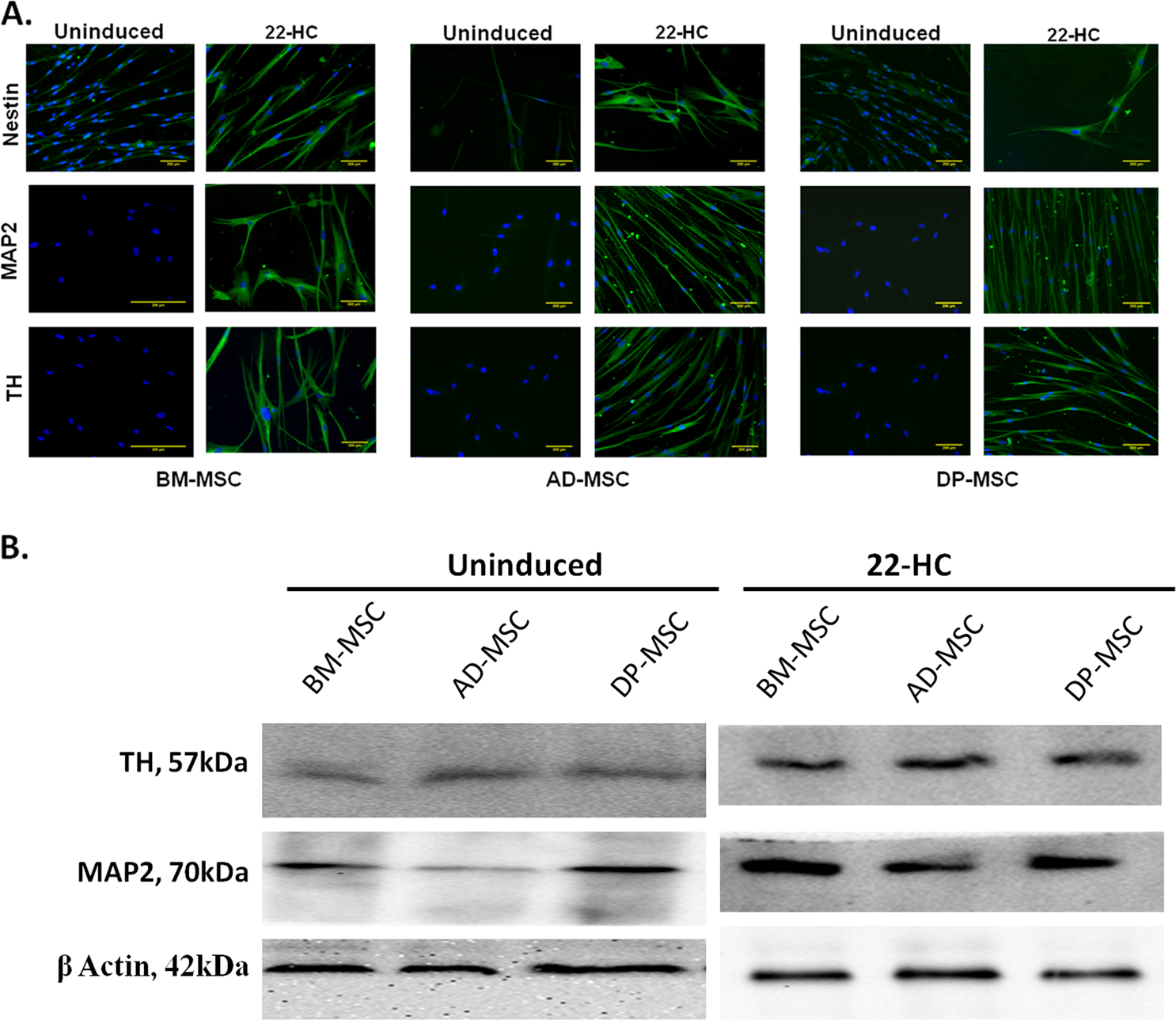 Fig. 3: Expression of neuronal cell-associated proteins in differentiated hMSCs.