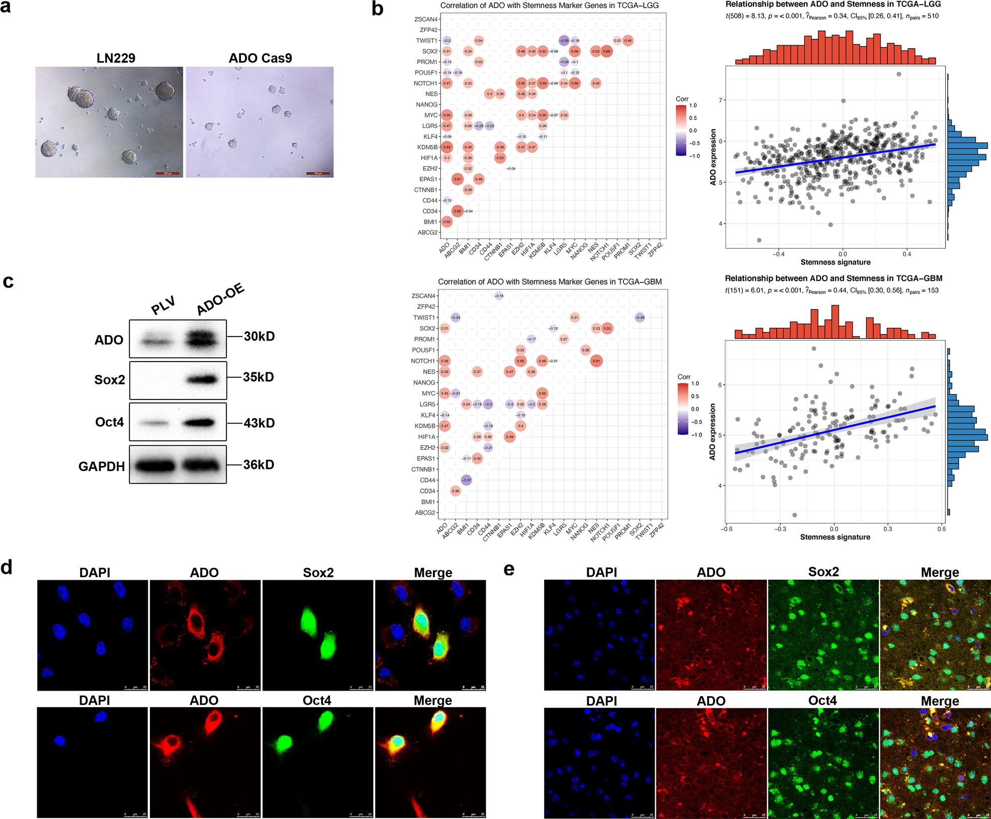 Fig. 3: ADO is upregulated in glioblastoma stem-like cells.