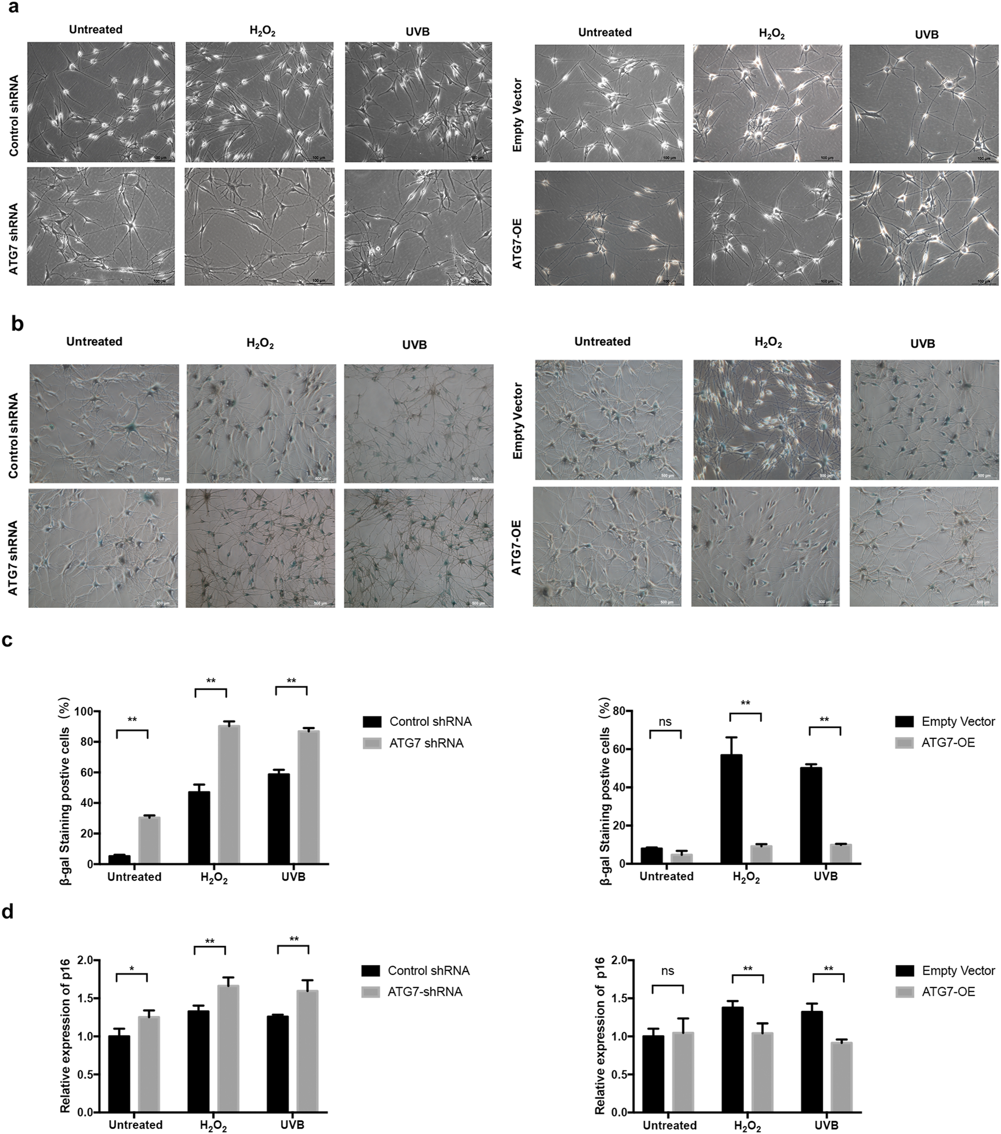 Fig. 4: Suppression of ATG7-dependent autophagy leads to premature senescence of NHEM under oxidative stress.