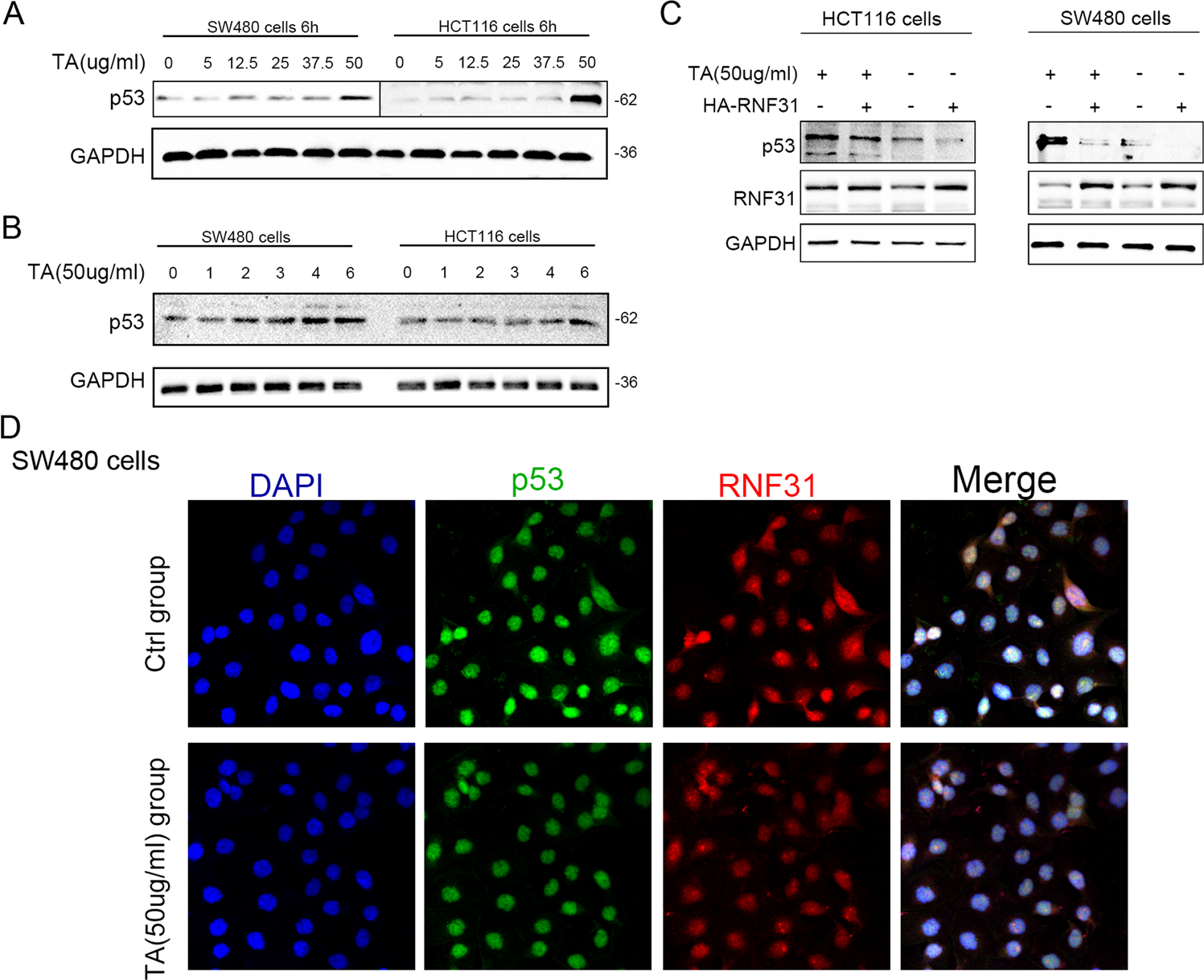 Fig. 8: TA induced p53 protein overexpression and promoted the interaction of p53 with RNF31.