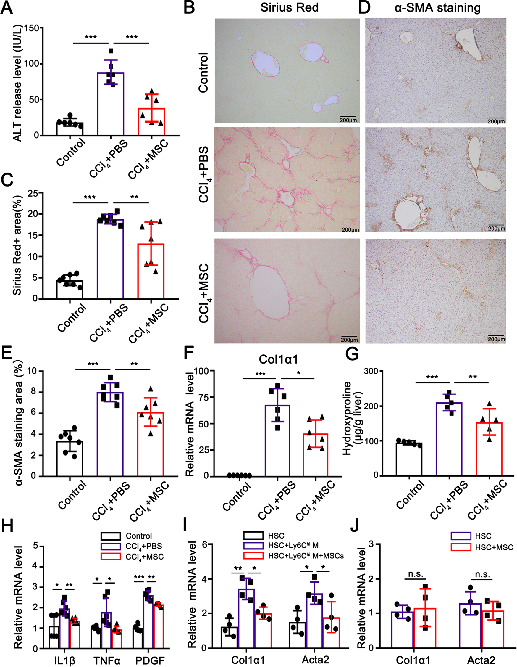 Fig. 1: BM-MSC transplantation attenuated CCl4-induced inflammatory levels and liver fibrosis.