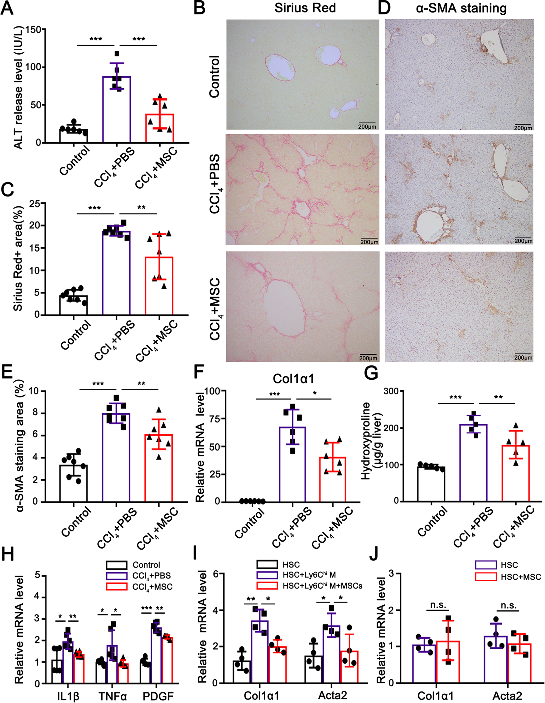 Mesenchymal stem cells attenuate liver fibrosis by targeting Ly6Chi/lo  macrophages through activating the cytokine-paracrine and apoptotic  pathways | Cell Death Discovery