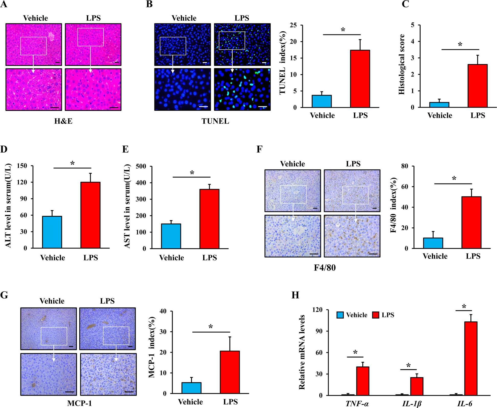 ARRB1 suppresses the activation of hepatic macrophages via modulating  endoplasmic reticulum stress in lipopolysaccharide-induced acute liver  injury | Cell Death Discovery