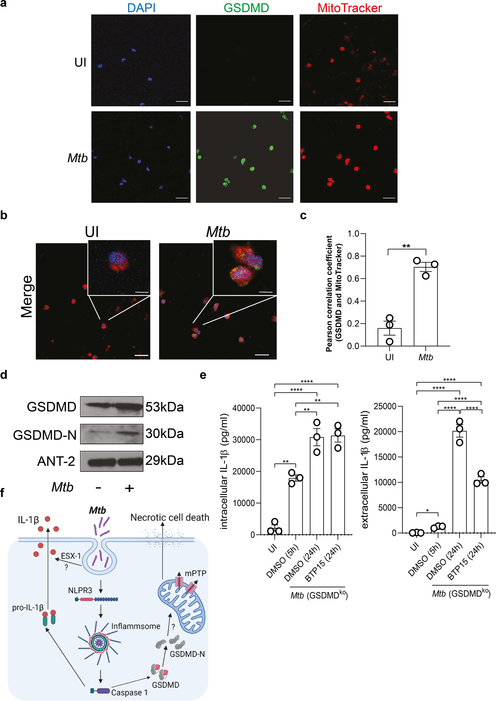 Fig. 6: GSDMD is associated with the mitochondria and Mtb ESX-1 influences IL-1β secretion in infected macrophages.