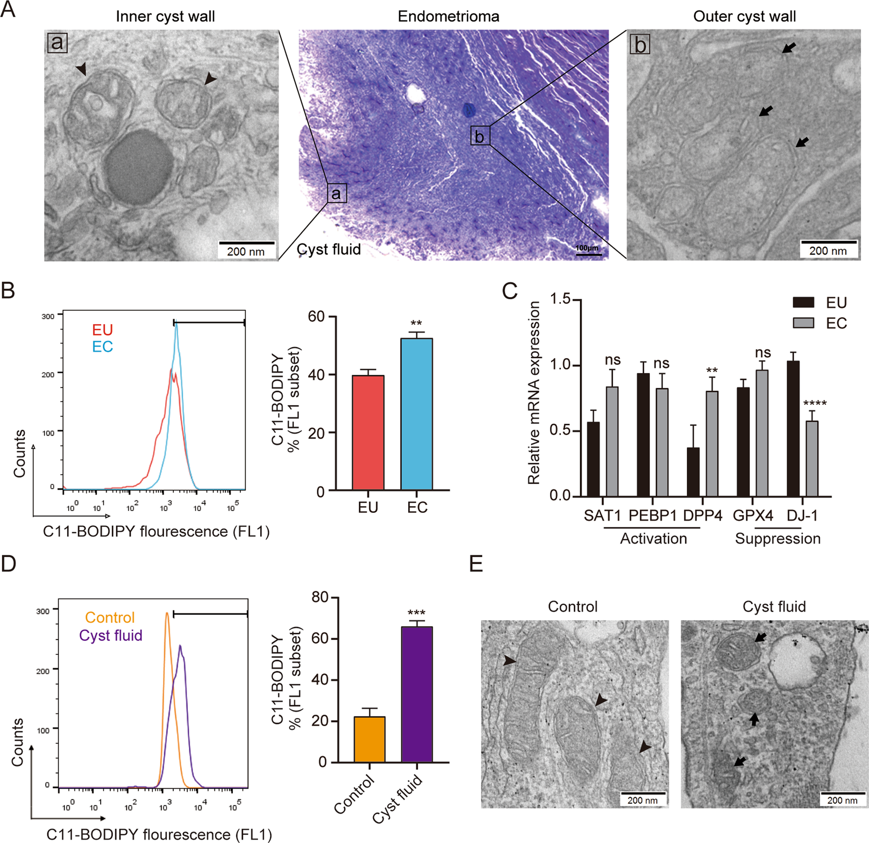 Endometrial stromal cell ferroptosis promotes angiogenesis in endometriosis | Cell Death Discovery Endometrial stromal cell ferroptosis promotes angiogenesis in endometriosis | Cell Death Discovery