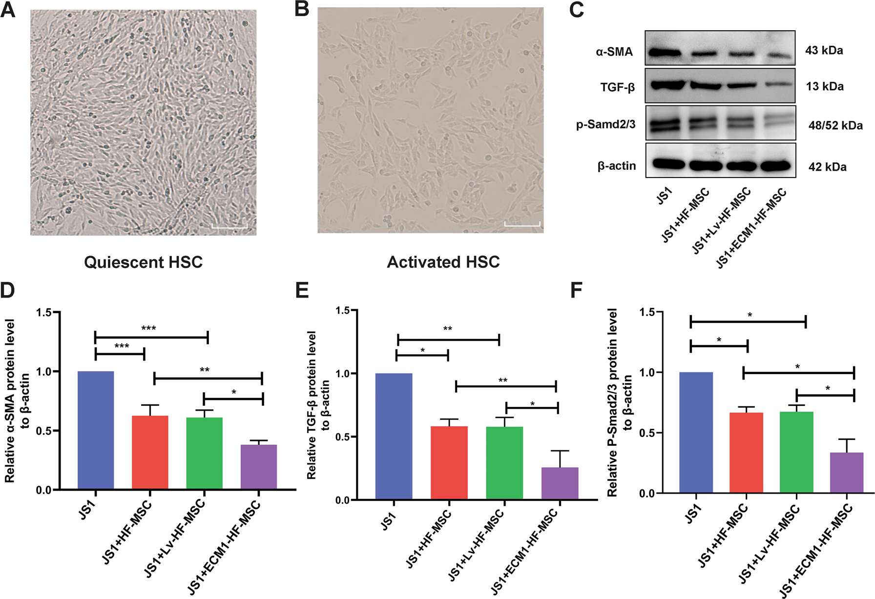 Fig. 5: ECM1-HF-MSCs inhibit the TGF-β/Smad signaling pathway and activation of HSCs in vitro.