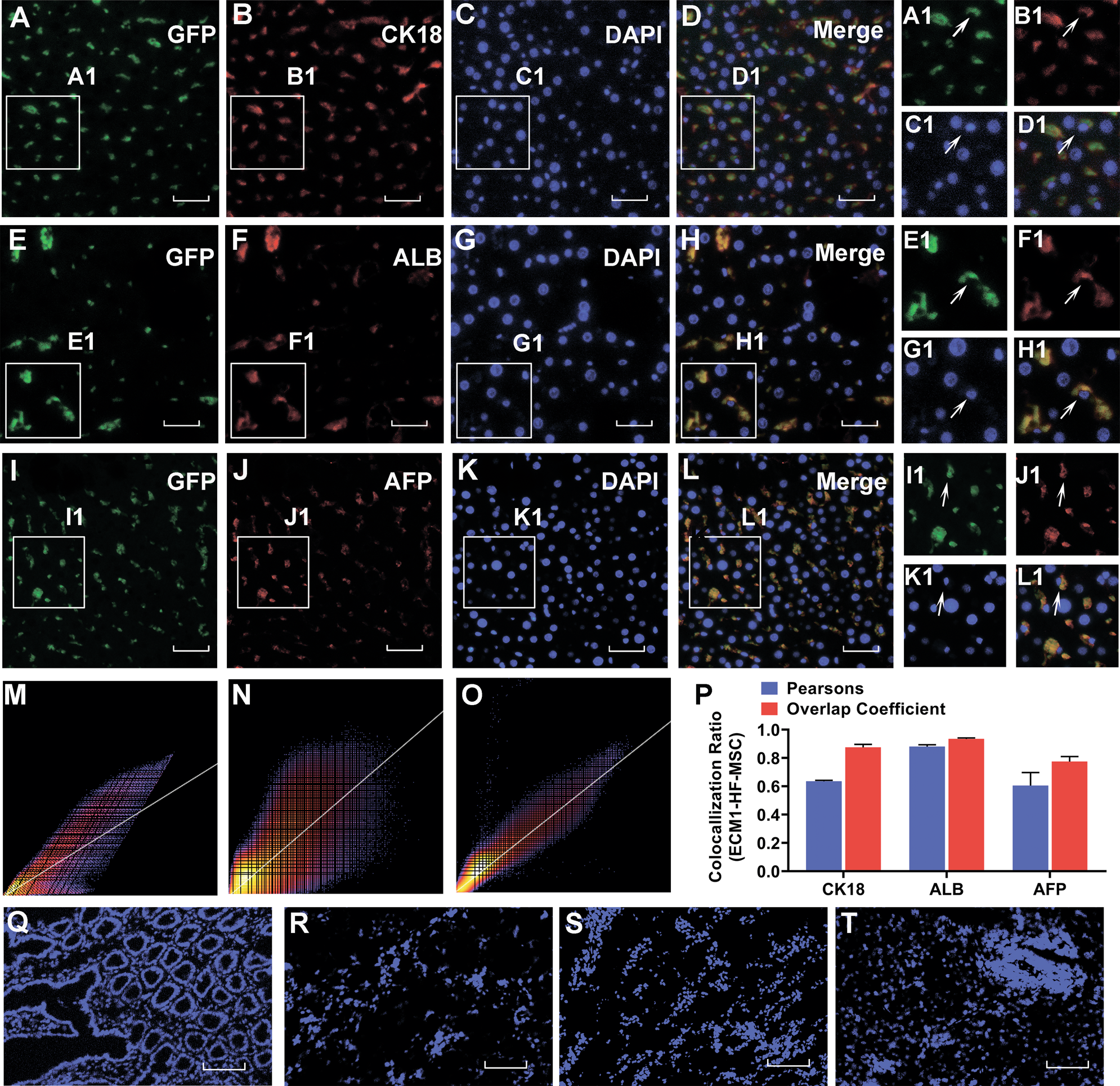 Fig. 6: ECM1-overexpressing HF-MSCs home to the injured liver site and differentiate into hepatocyte-like cells.