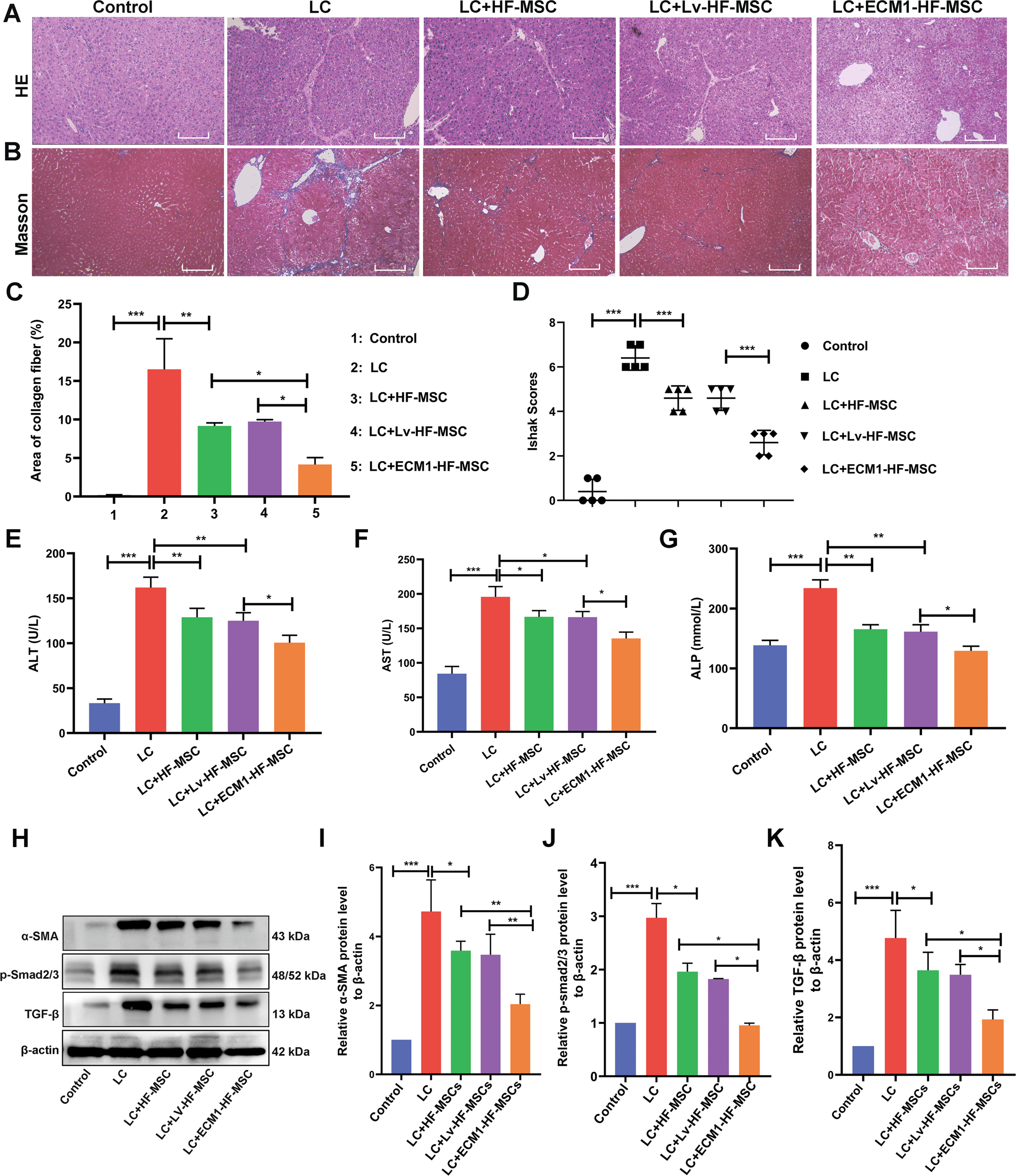 Fig. 7: ECM1-HF-MSCs show a better effect in LC treatment through inhibiting the activation of HSCs and the TGF-β/Smad signaling pathway in vivo.