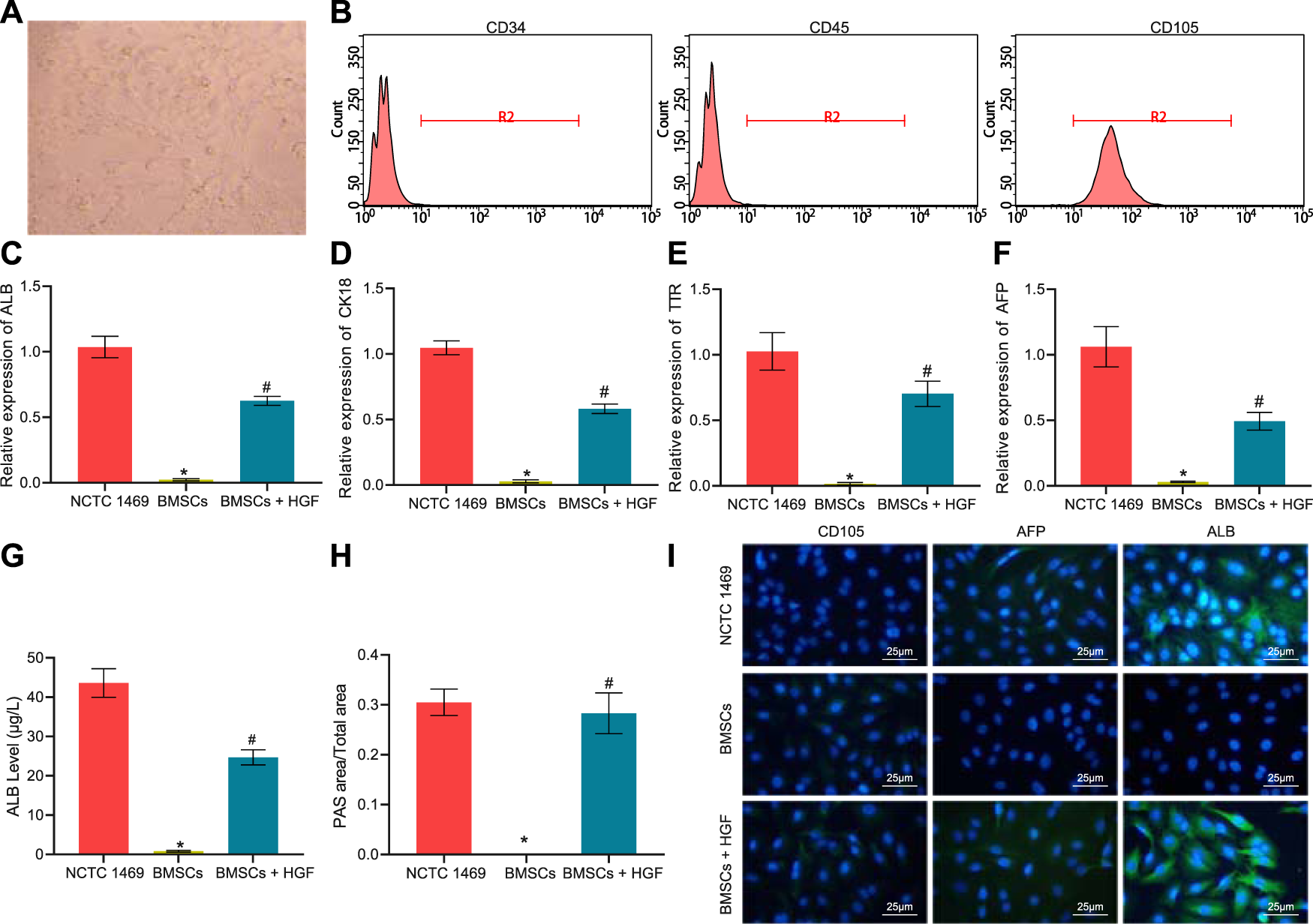 Long noncoding RNA SNHG1 silencing accelerates hepatocyte-like cell  differentiation of bone marrow-derived mesenchymal stem cells to alleviate  cirrhosis via the microRNA-15a/SMURF1/UVRAG axis | Cell Death Discovery