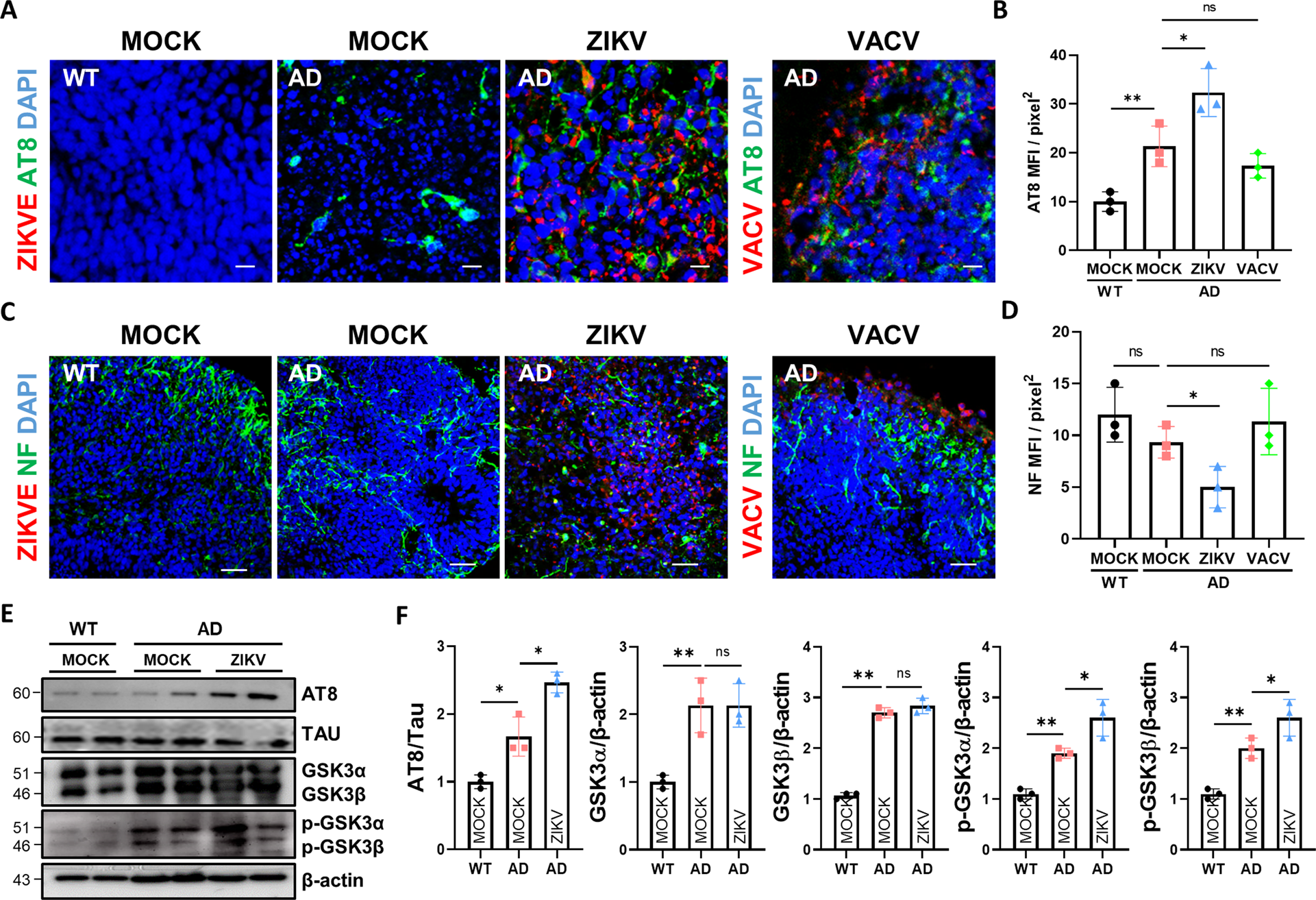 Fig. 4: ZIKV infection enhances p-TAU levels in AD organoids through GSK3α/β.