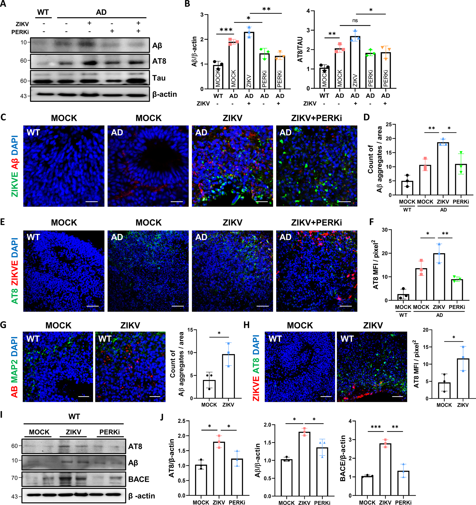 Fig. 6: PERK inhibitor attenuated AD phenotypes including Aβ and p-Tau.