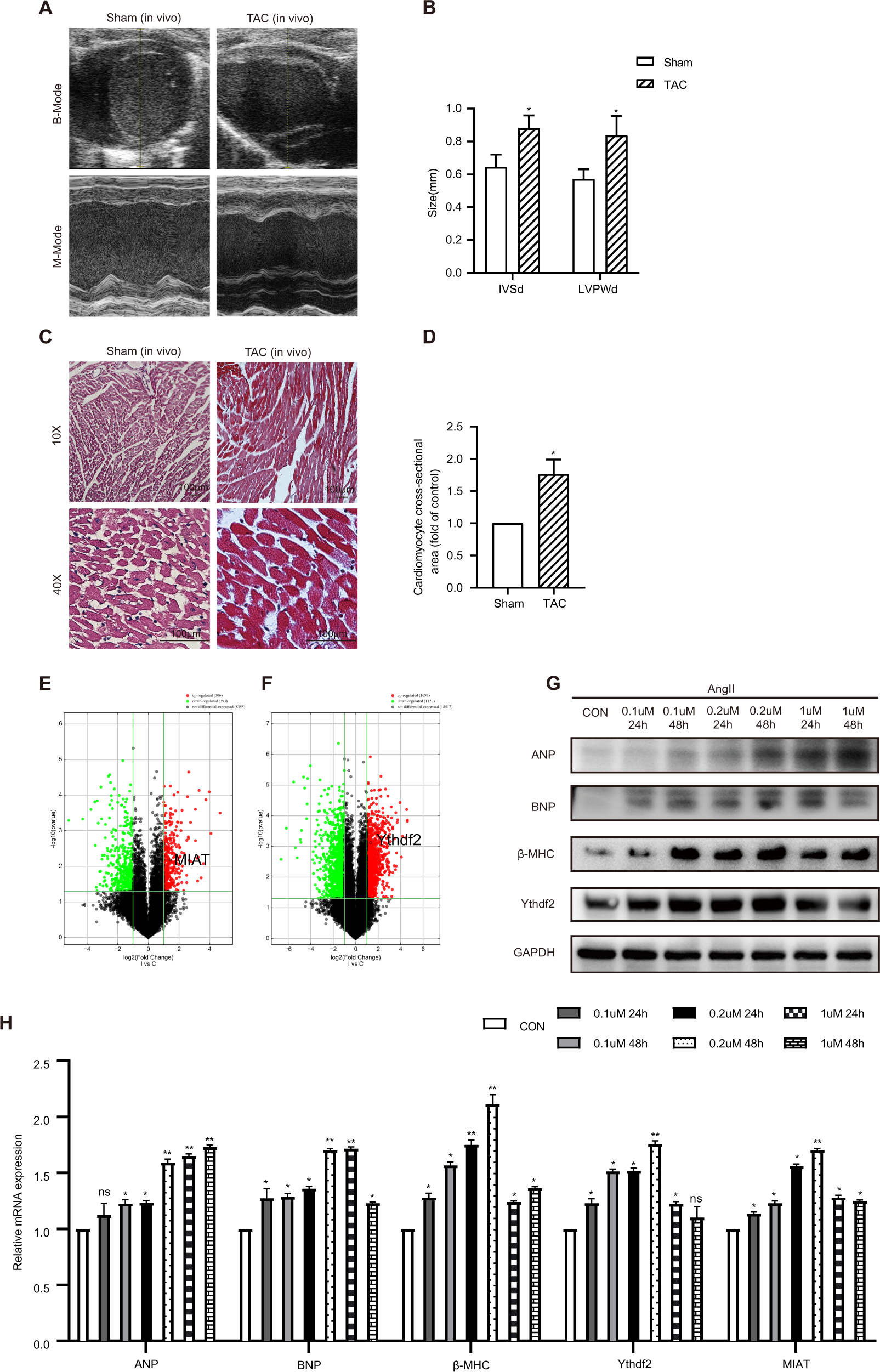 The lncRNA MIAT regulates CPT-1a mediated cardiac hypertrophy through m6A  RNA methylation reading protein Ythdf2 | Cell Death Discovery