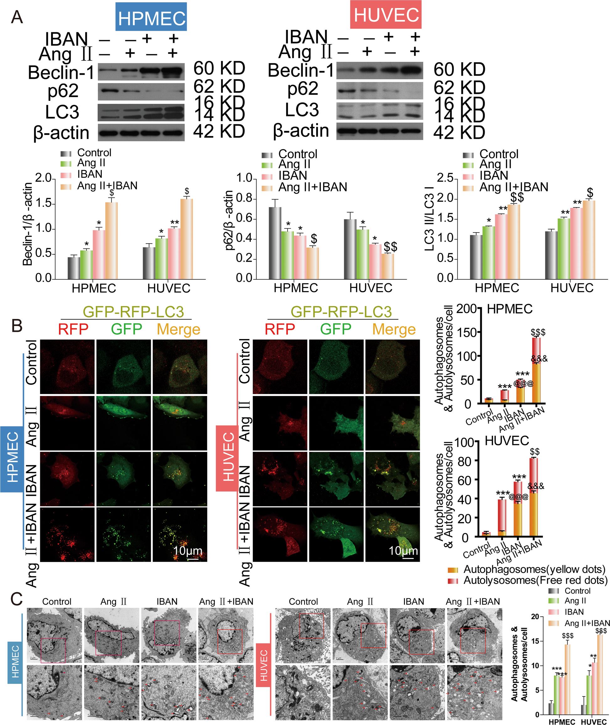 Fig. 2: Effect of IBAN in Ang II-treated HUVECS and HPMECs.