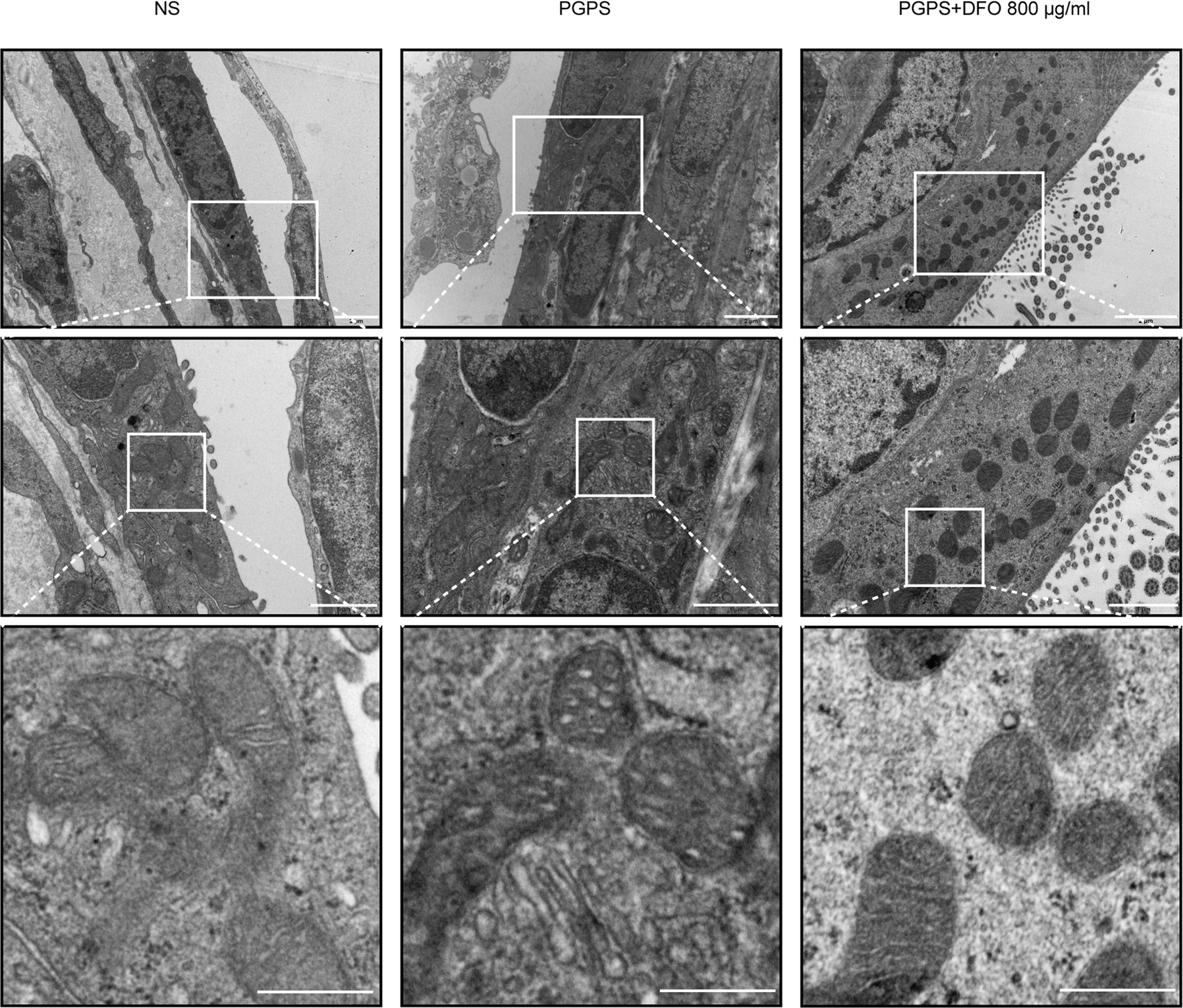 Fig. 6: DFO attenuates inflammation-induced mitochondrial damage.