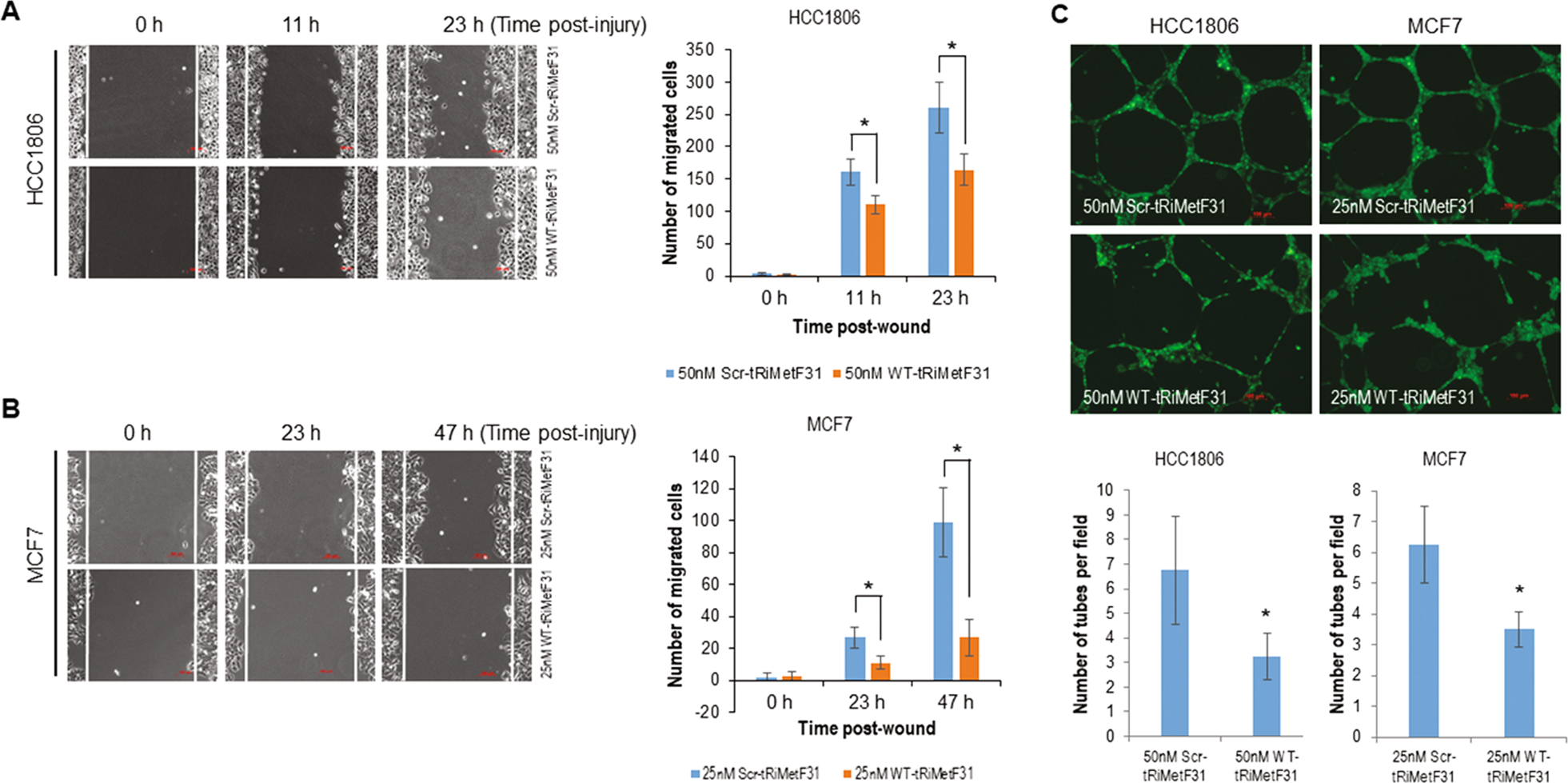 Fig. 5: Ectopic tRiMetF31 inhibited the migration and angiogenesis of breast cancer cells.