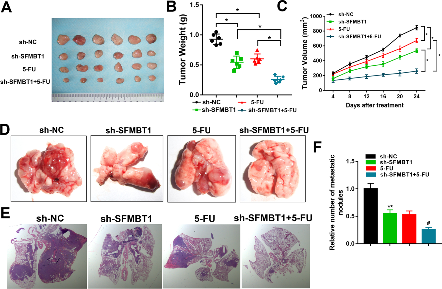 Fig. 3: SFMBT1 knockdown in mouse xenograft model reduces drug resistance and metastasis.
