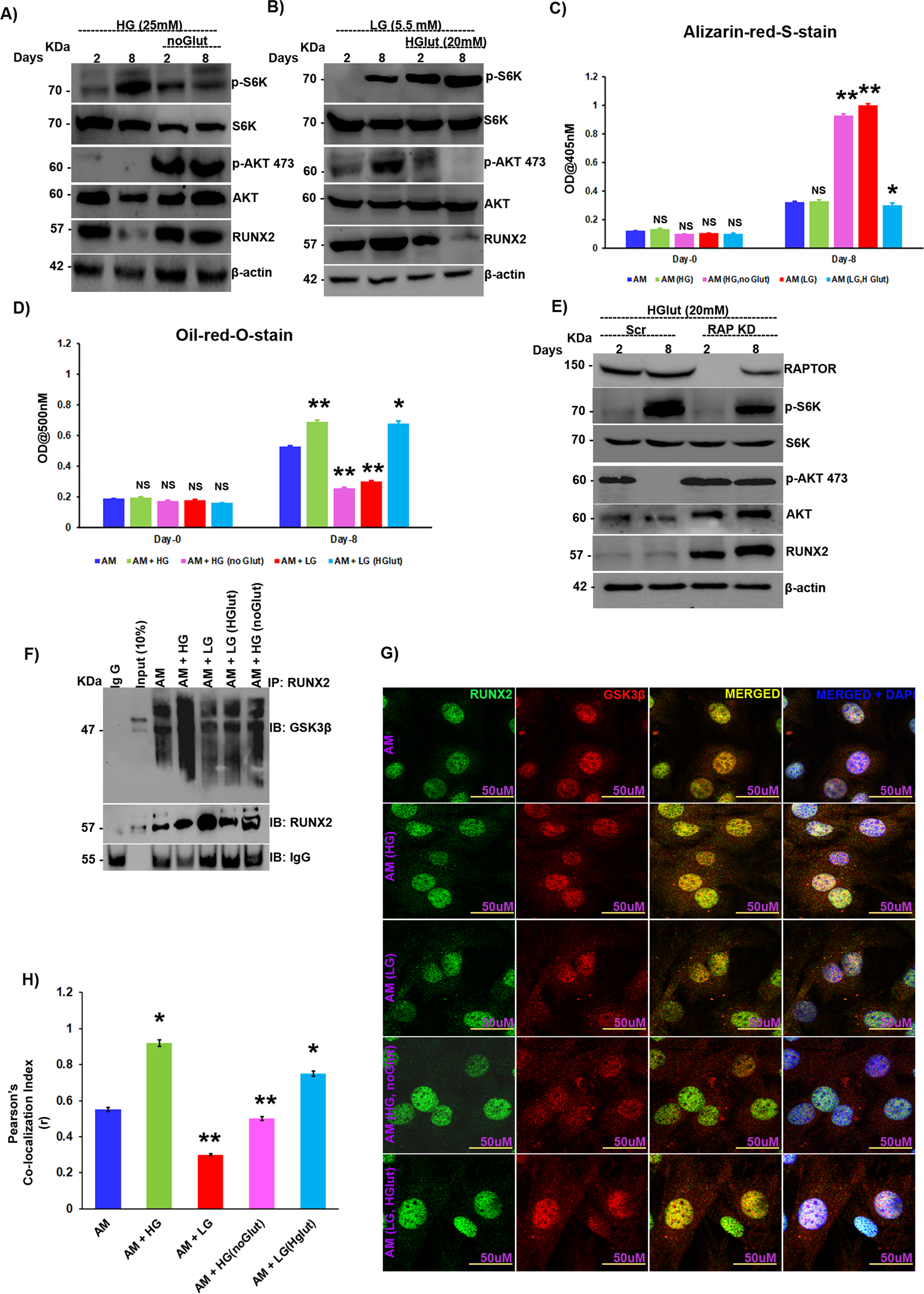 Fig. 5: High glucose-induced glutamine sparing triggers RUNX2 loss under diabetic conditions.
