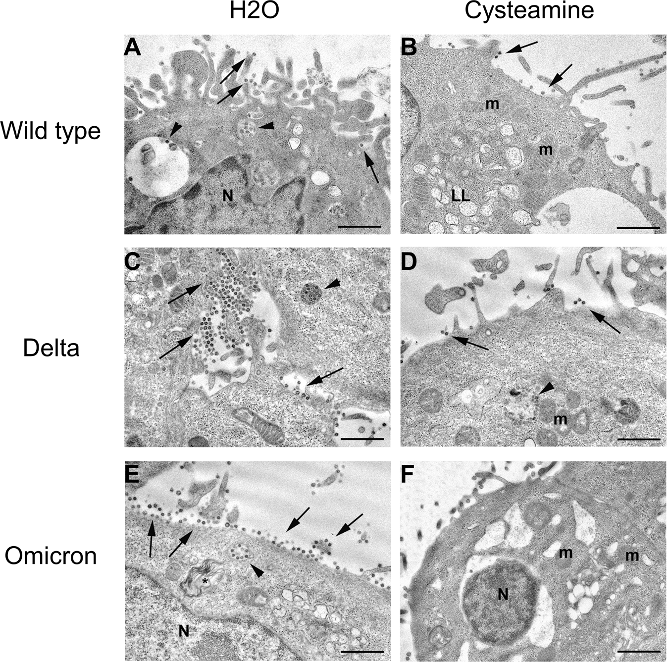 Fig. 3: Electron microscopy images of Vero E6 cells infected with SARS-CoV-2 variants.