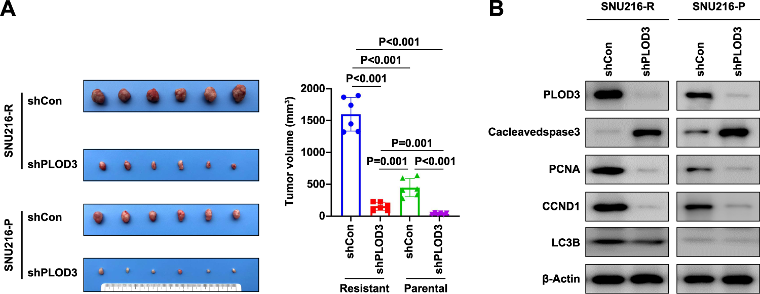 Fig. 2: PLOD3 was the key regulator for Trastuzumab resistance in gastric cancer in vivo.