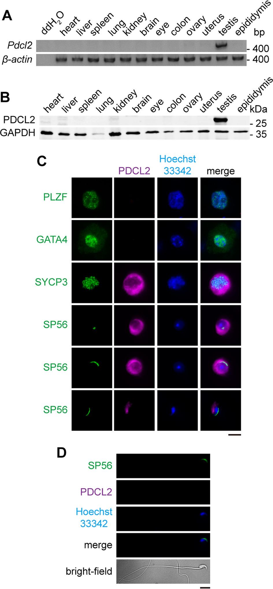 PDCL2 is essential for spermiogenesis and male fertility in mice