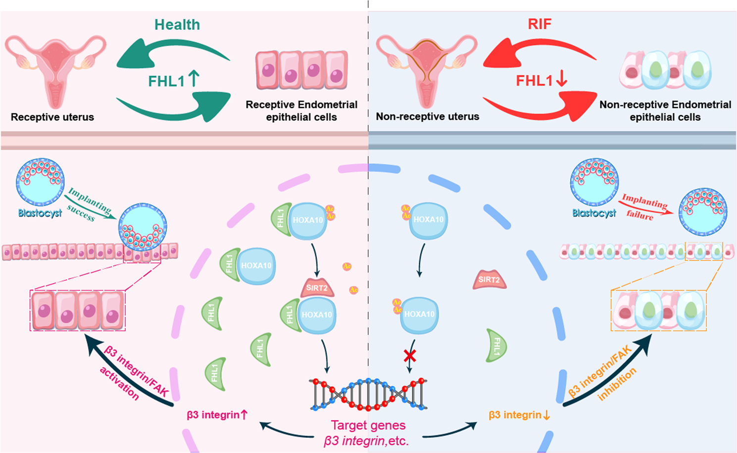 Fig. 8: Schematic diagram of the role of FHL1-mediated HOXA10 deacetylation in the regulation of blastocyst epithelial adhesion in RIF patients and fertile controls.
