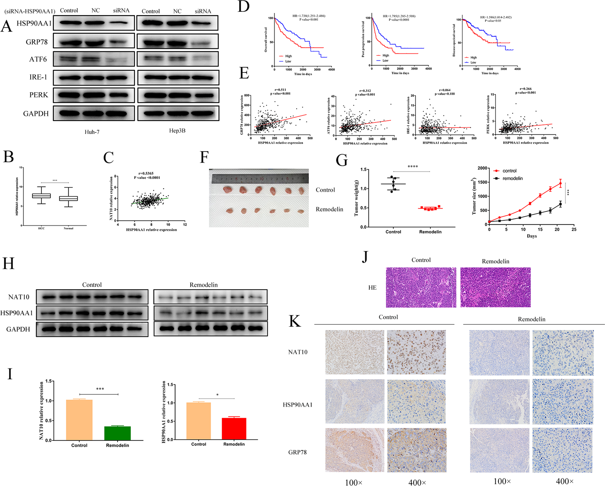 Fig. 6: NAT10 can promote the expression of the HSP90AA1 gene in ERS HCC.