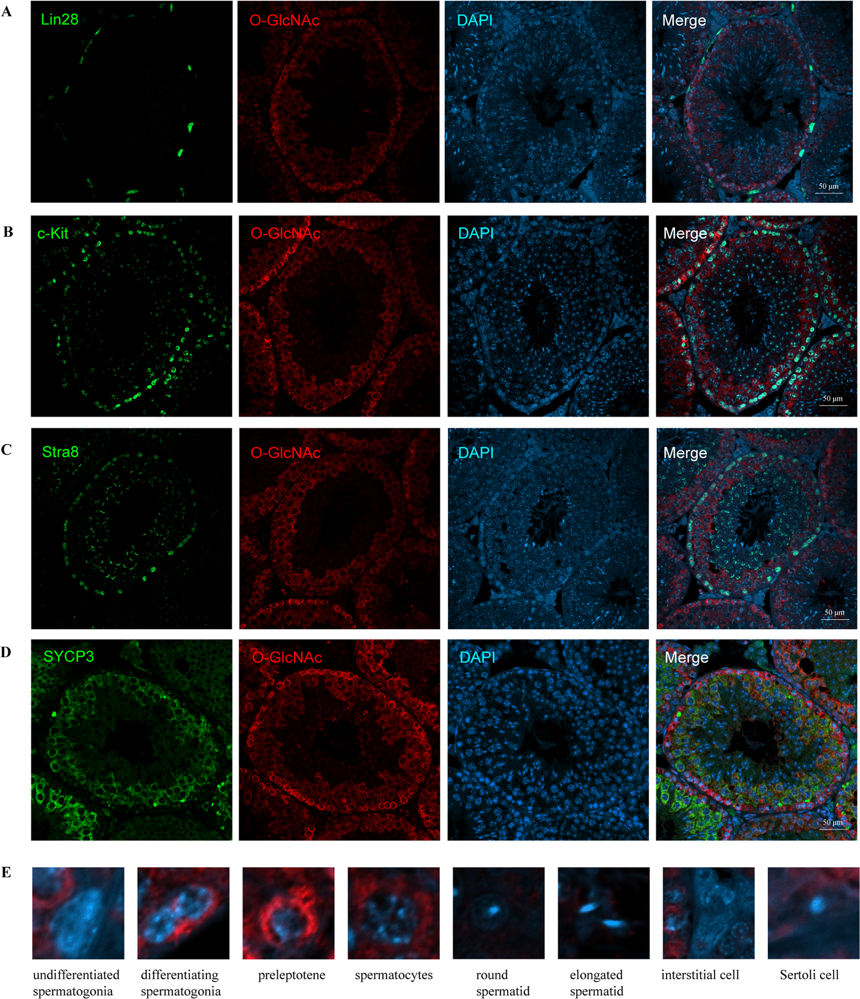 Mitochondrial defects caused by PARL deficiency lead to arrested  spermatogenesis and ferroptosis