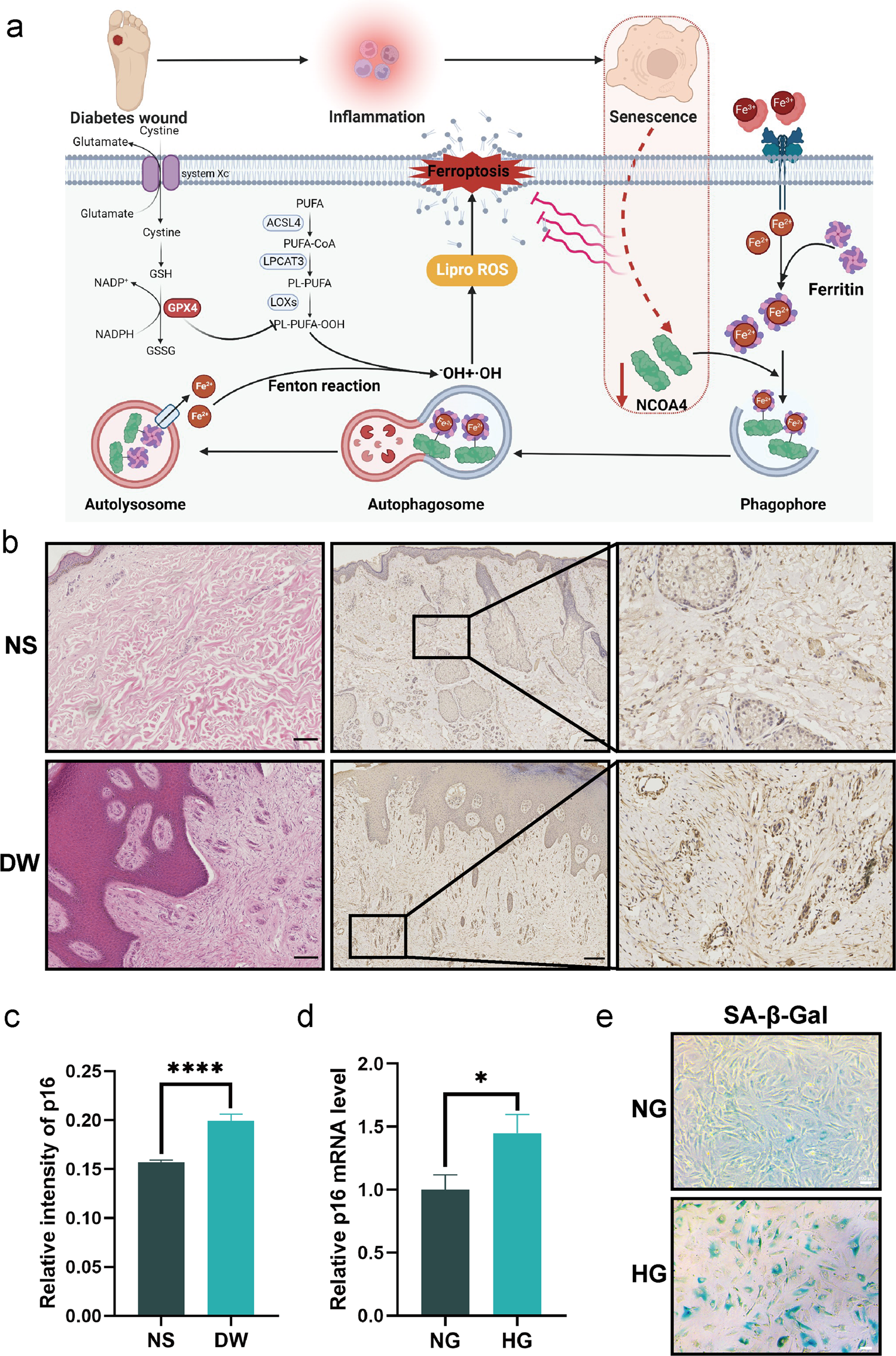 Fig. 1: Senescence is linked to diabetic wounds.