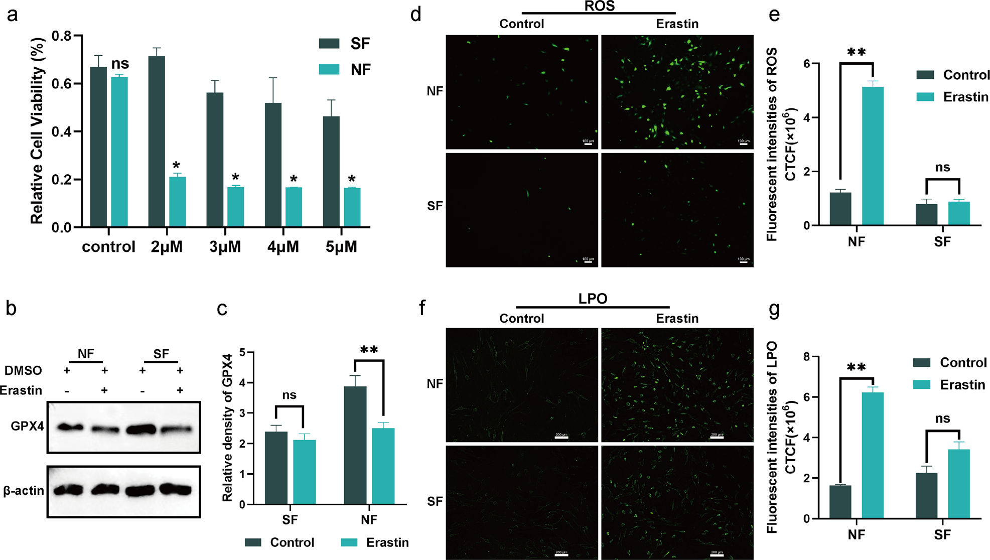 Fig. 2: Senescent fibroblasts exhibit a ferroptosis-resistant phenotype.