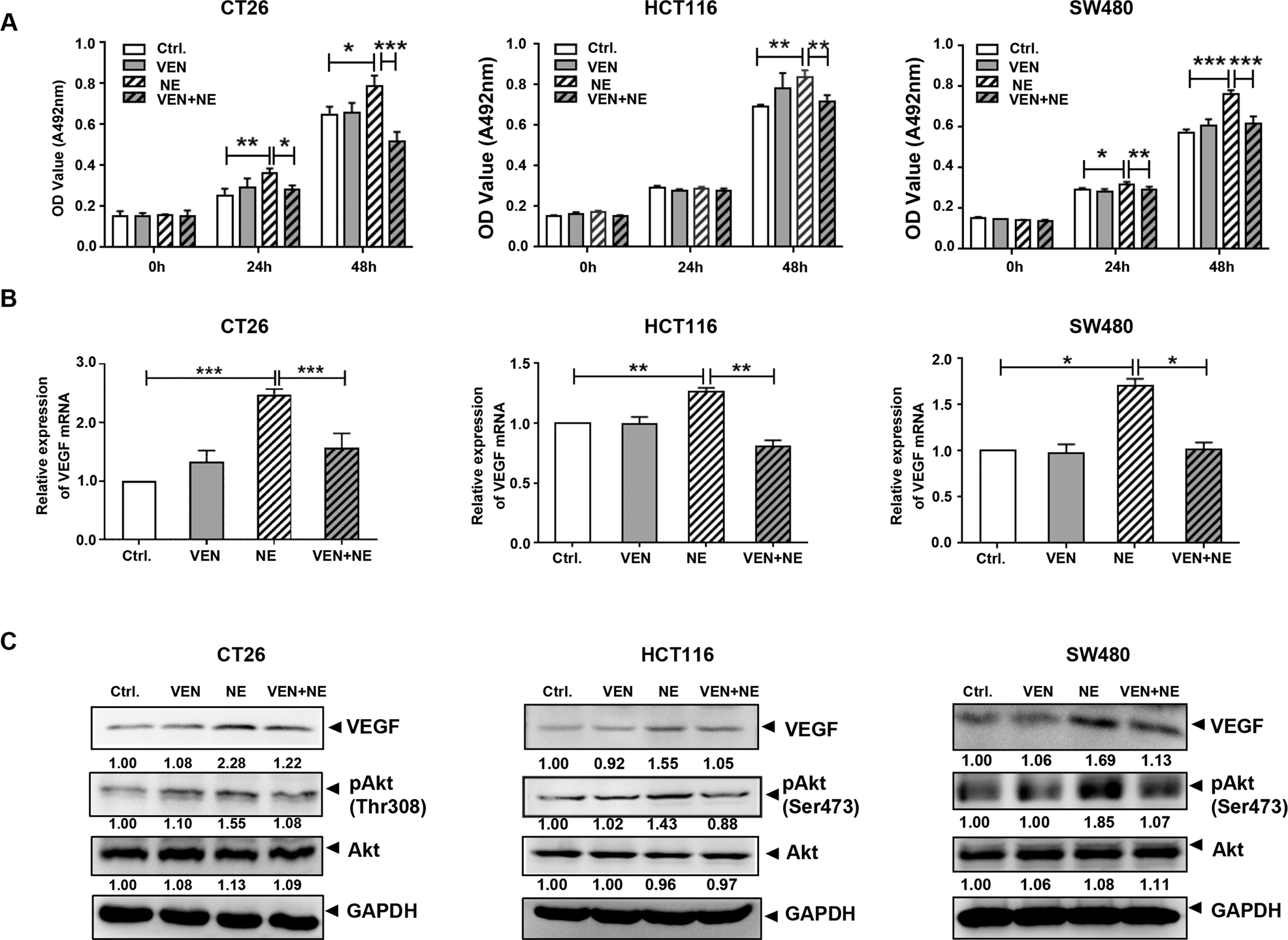 Fig. 2: Venlafaxine (VEN) inhibits the norepinephrine (NE)-enhanced cell viability and vascular endothelial growth factor (VEGF) expression in colon cancer cells.