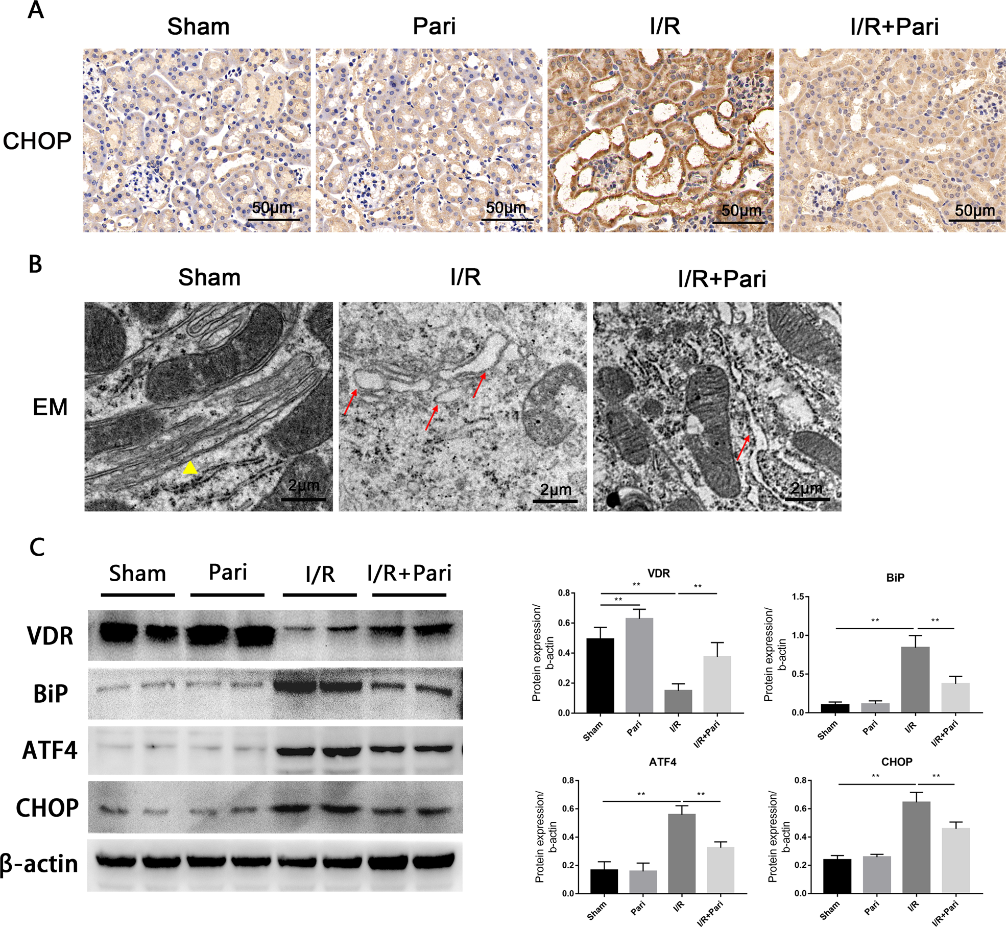 Fig. 2: Paricalcitol attenuated I/R-induced ERS.