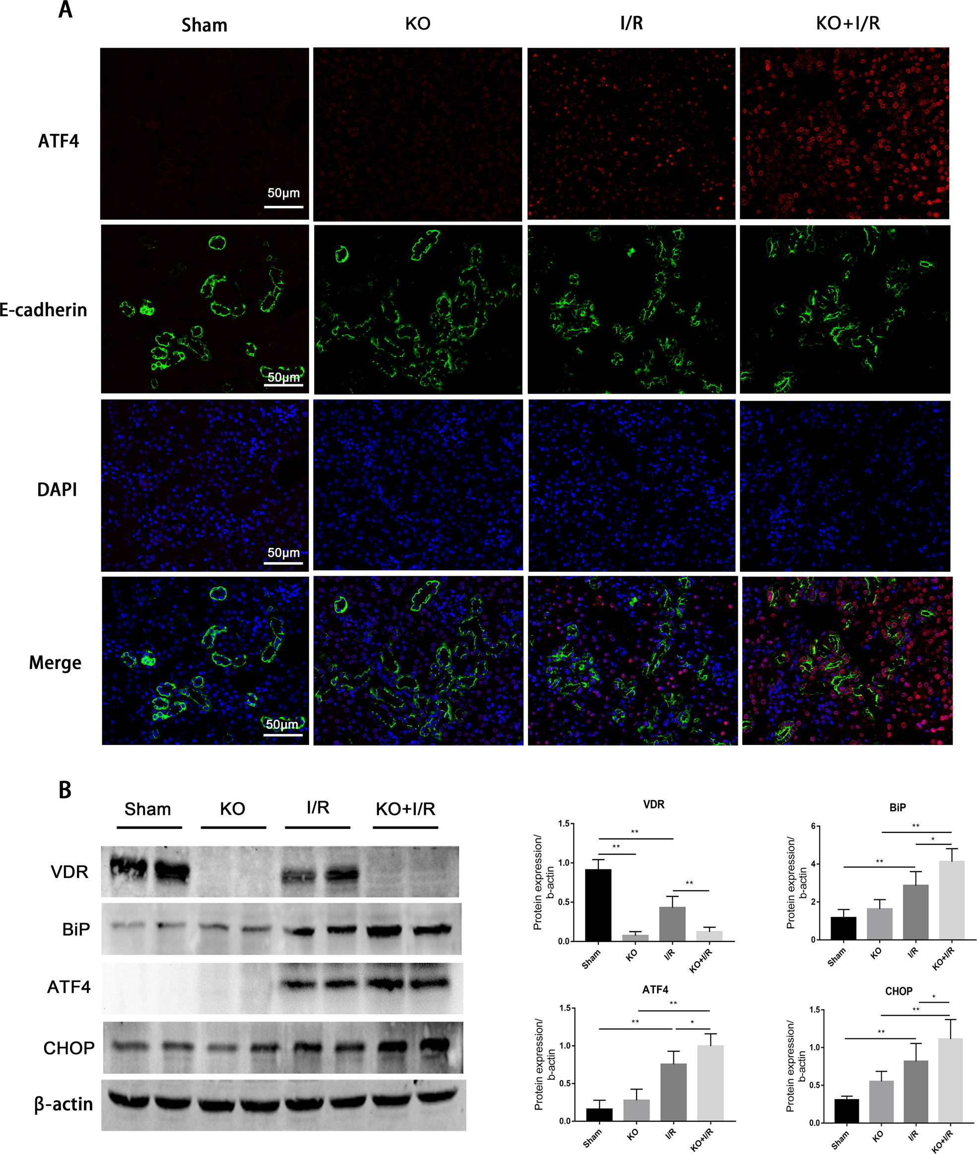 Fig. 4: VDR knockout aggravated I/R induced ERS.
