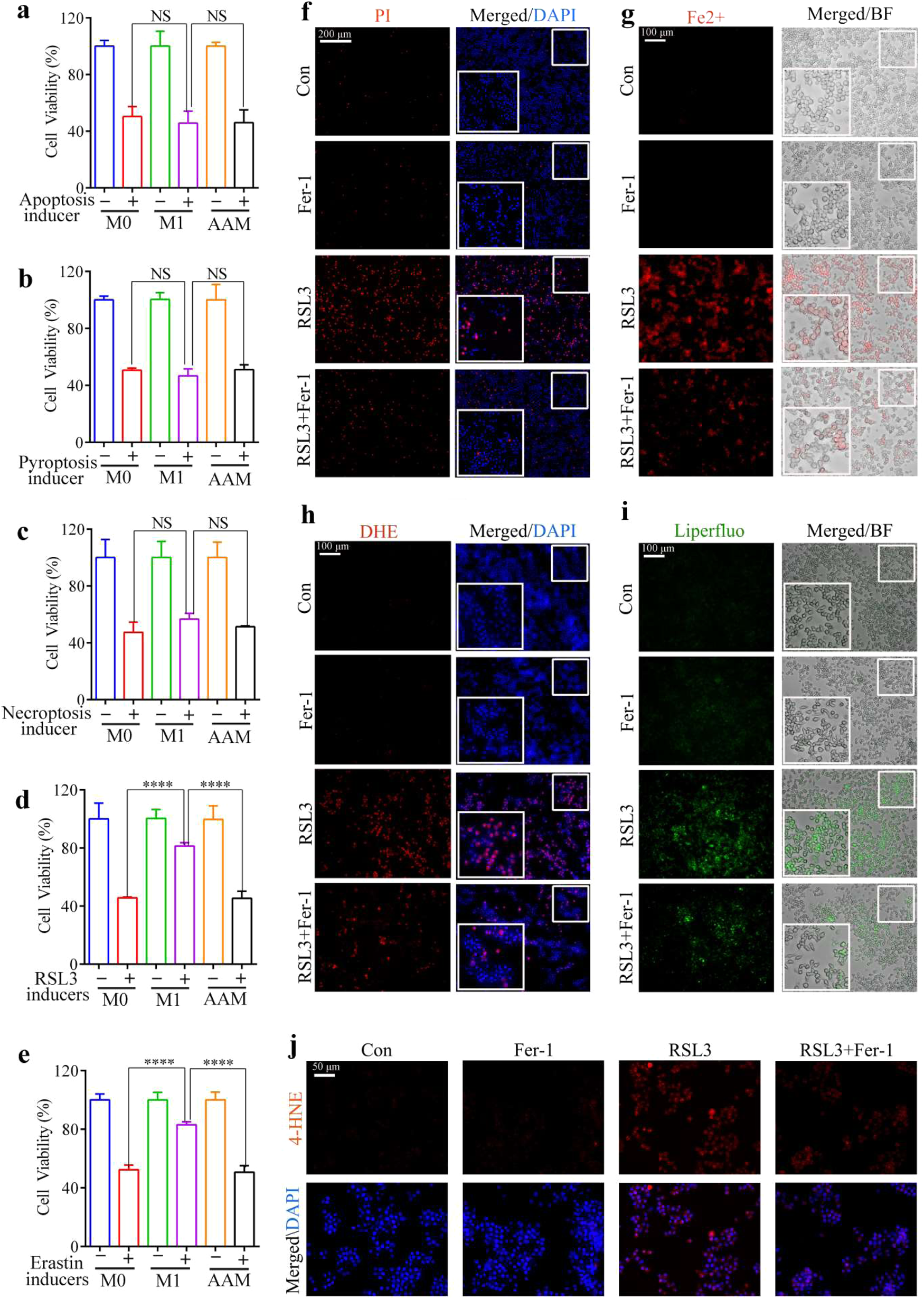 Role of liensinine in sensitivity of activated macrophages to ferroptosis  and in acute liver injury | Cell Death Discovery