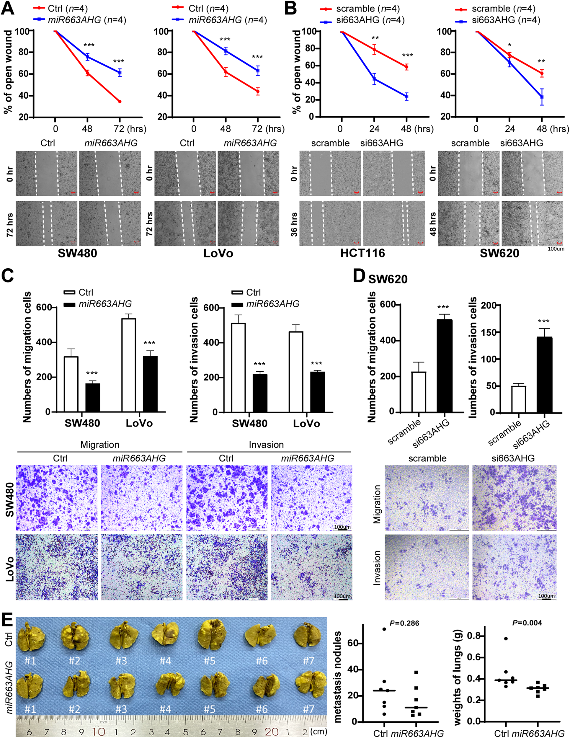 Fig. 4: Effects of miR663AHG on cell migration/invasion and lung metastasis of colon cancer cells in vitro and in vivo.