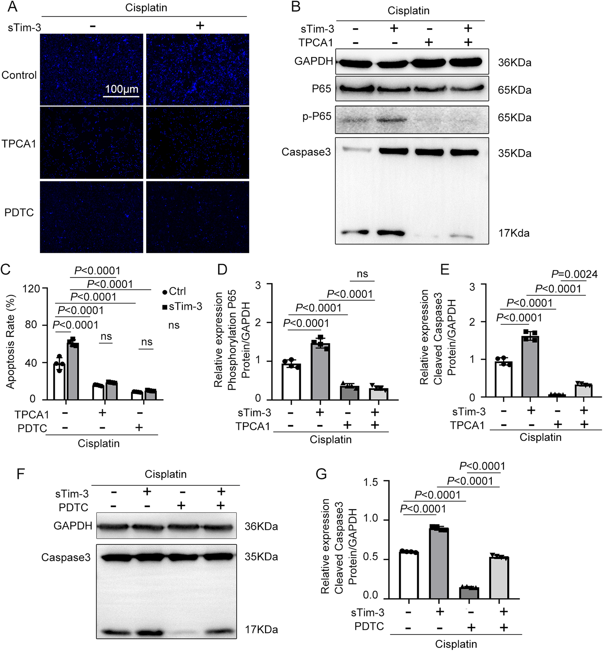 Fig. 5: The effect of NF-κB inhibitors and sTim-3 on kidney tubular epithelial cells’ apoptosis.
