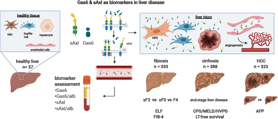 Gas6 in chronic liver disease—a novel blood-based biomarker for liver  fibrosis | Cell Death Discovery