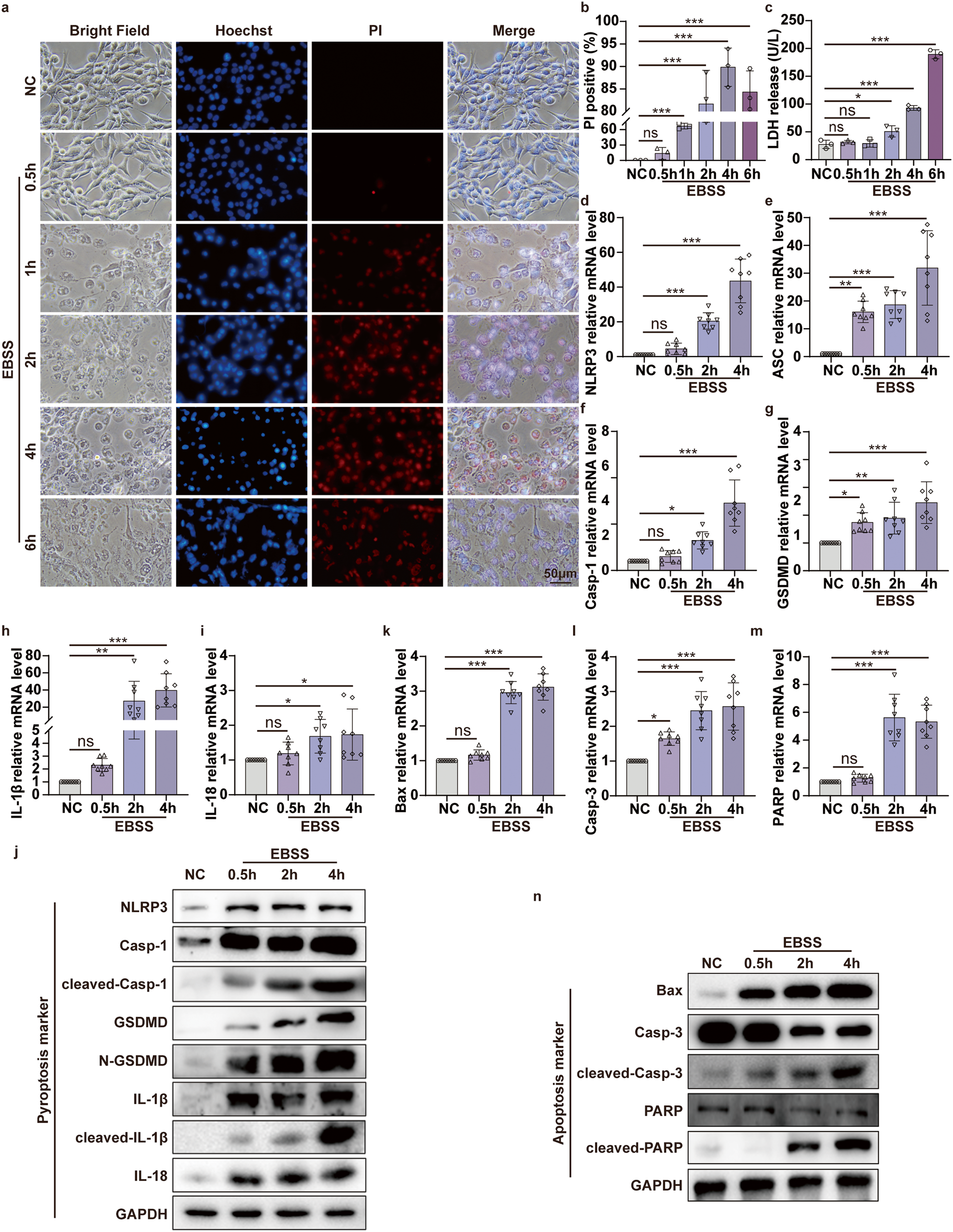 Fig. 2: Pyroptosis and apoptosis both occur in C2C12 cells of glucose deprivation in vitro ischemic model.