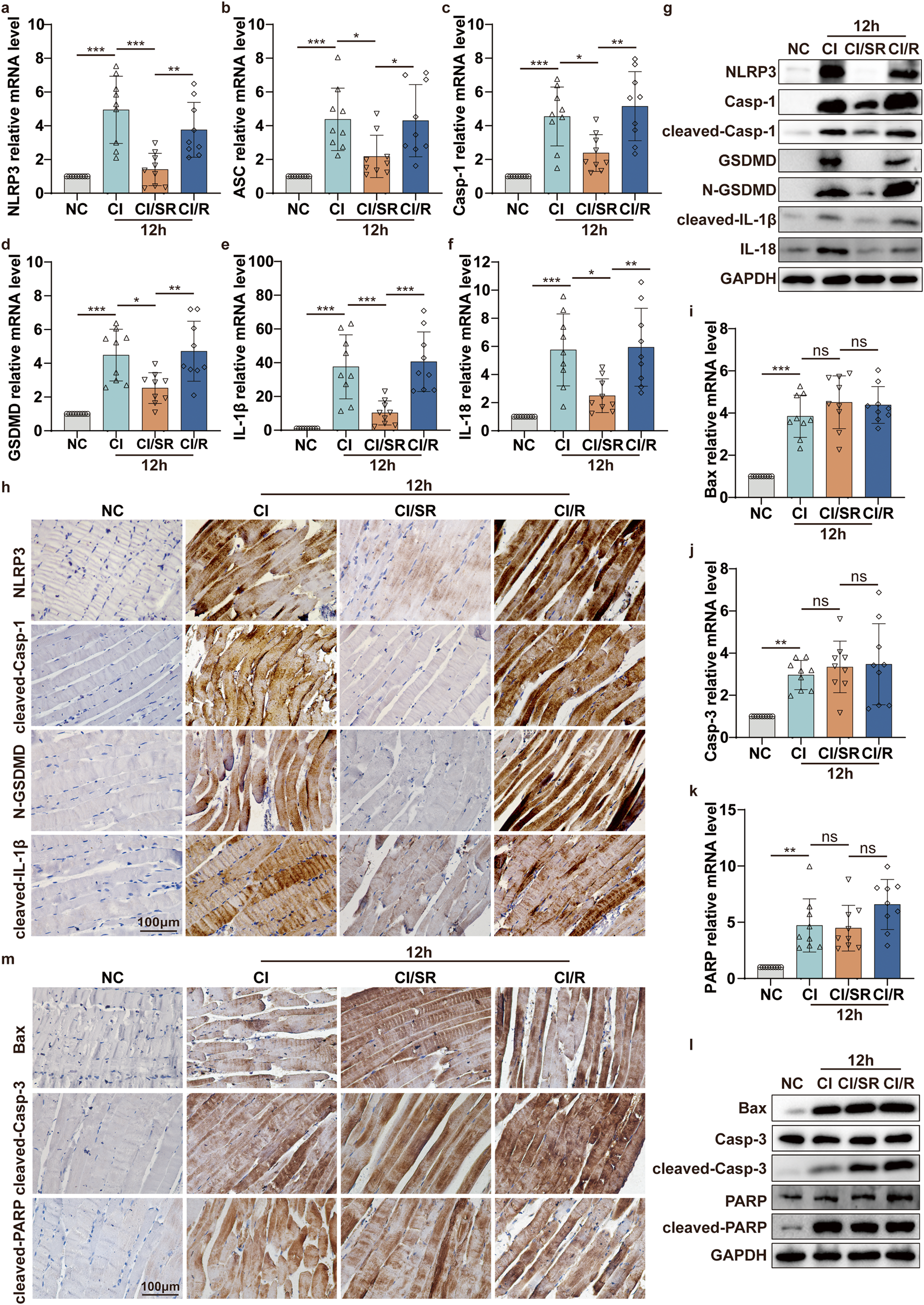 Fig. 6: Delayed step-by-step decompression significantly alleviates cell pyroptosis in skeletal muscle of CI mediated by NLRP3/Casp-1/GSDMD pathway.